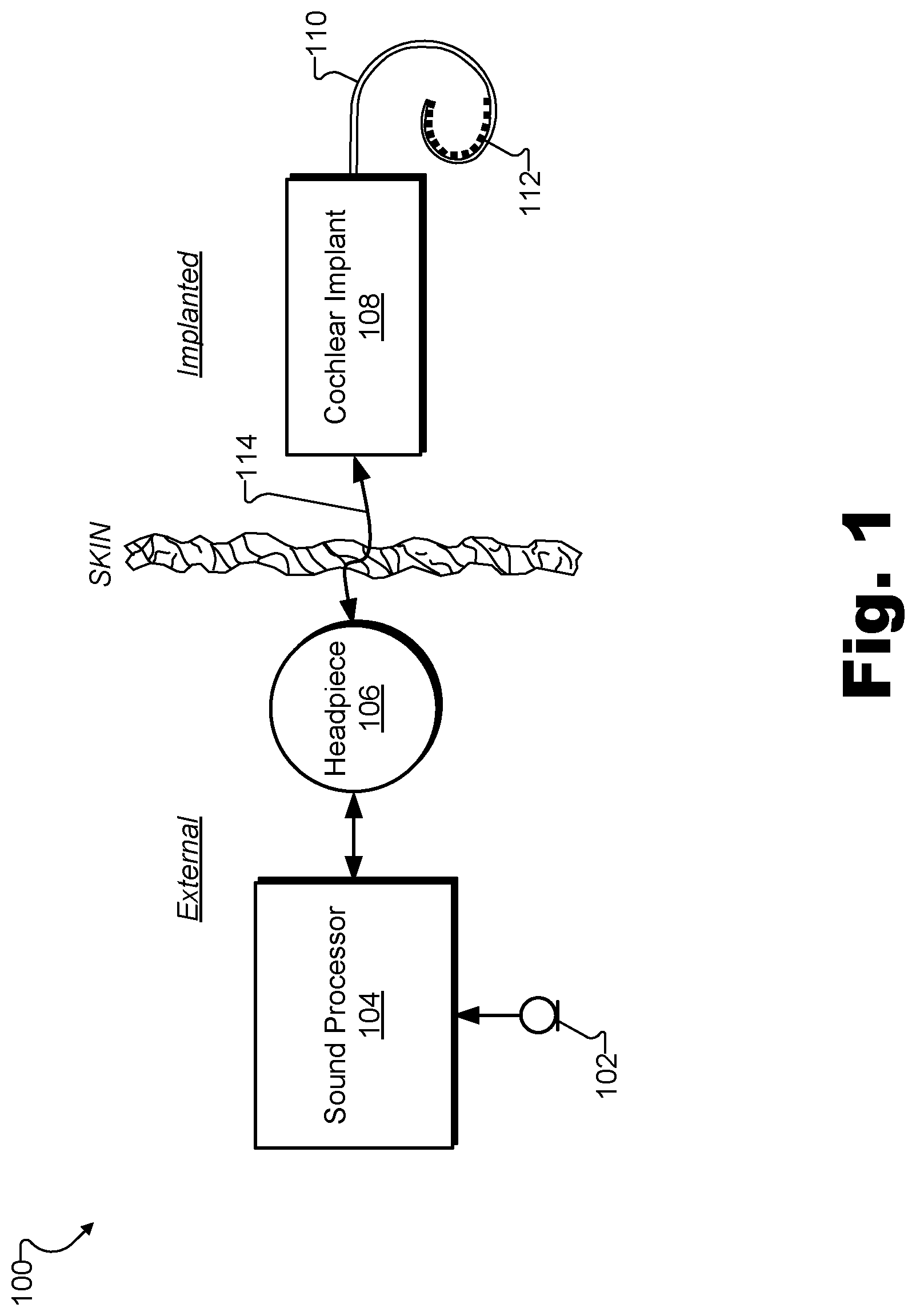 Patent US12311172 Figure 1 – Systems and methods for measuring evoked responses from a brain of a patient