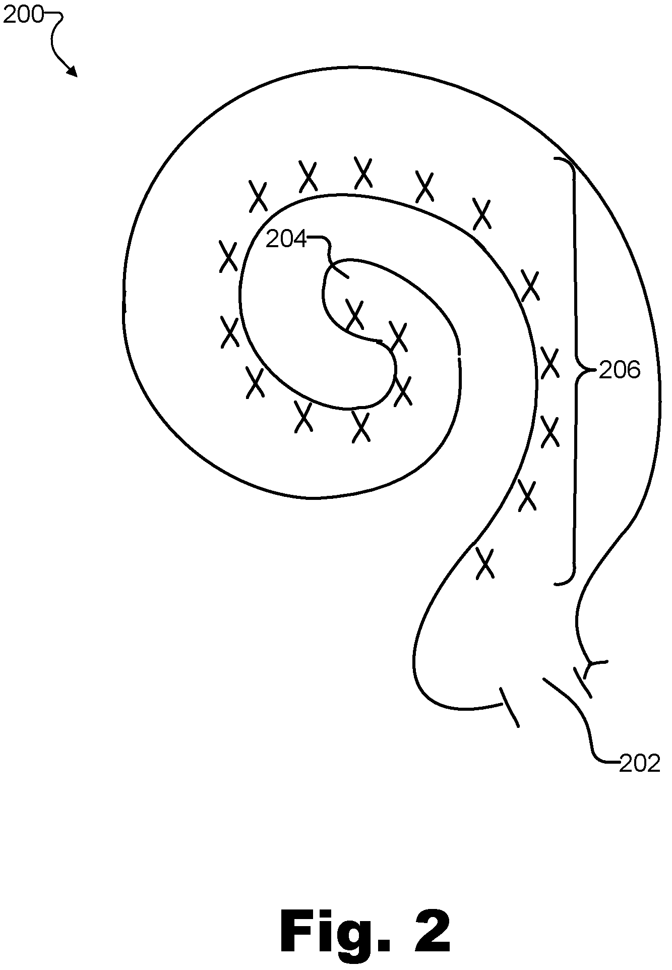 Patent US12311172 Figure 2 – Systems and methods for measuring evoked responses from a brain of a patient
