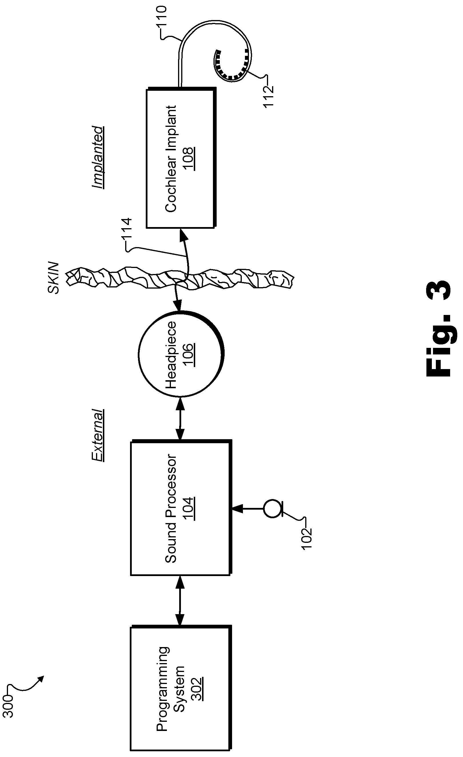Patent US12311172 Figure 3 – Systems and methods for measuring evoked responses from a brain of a patient