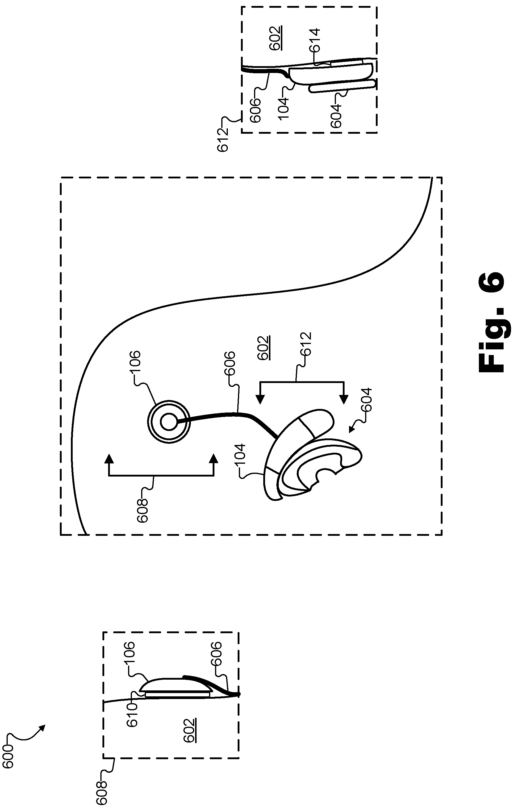 Patent US12311172 Figure 6 – Systems and methods for measuring evoked responses from a brain of a patient