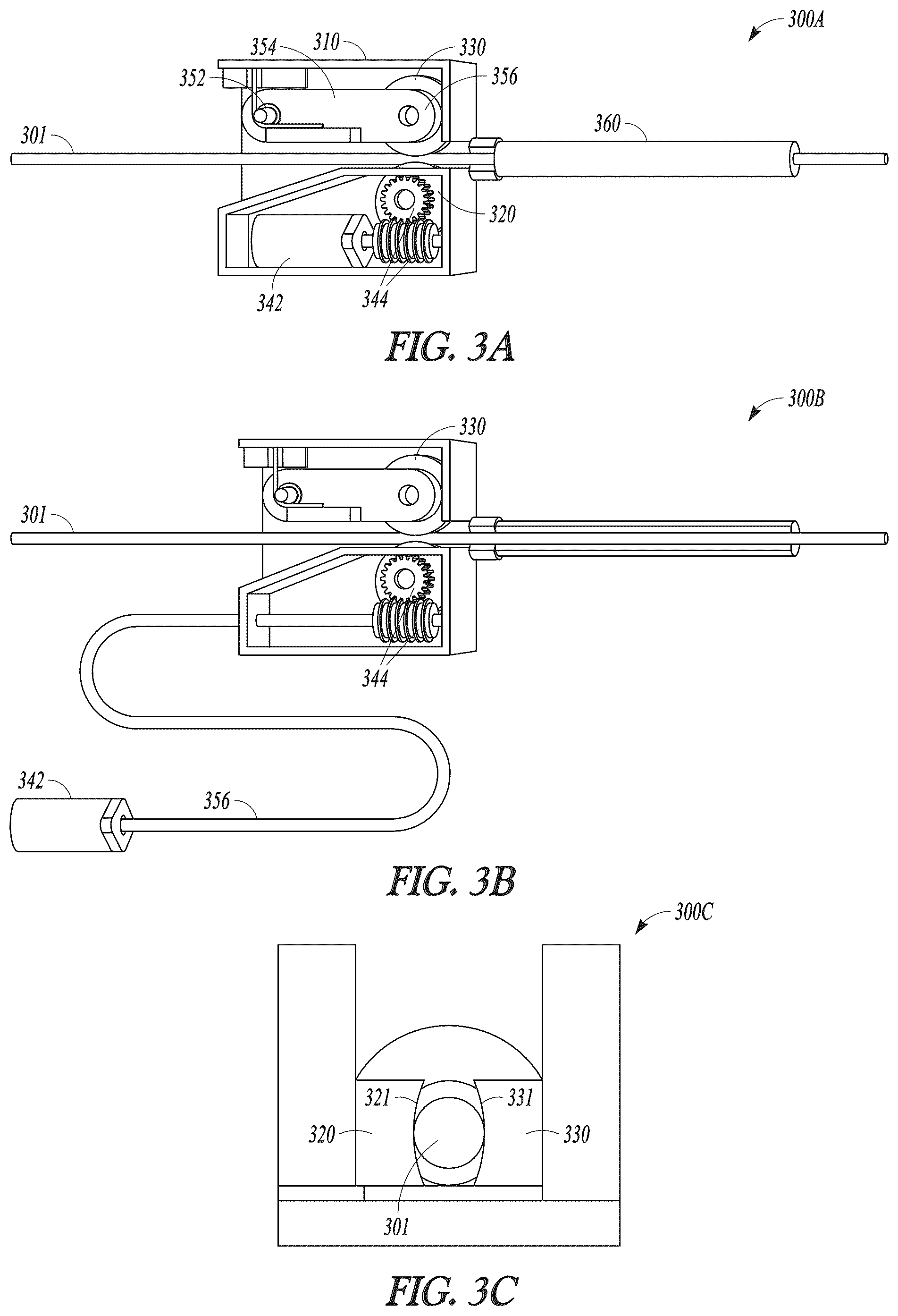 Patent US12311173 Figure 3 – Modular implant delivery and positioning system