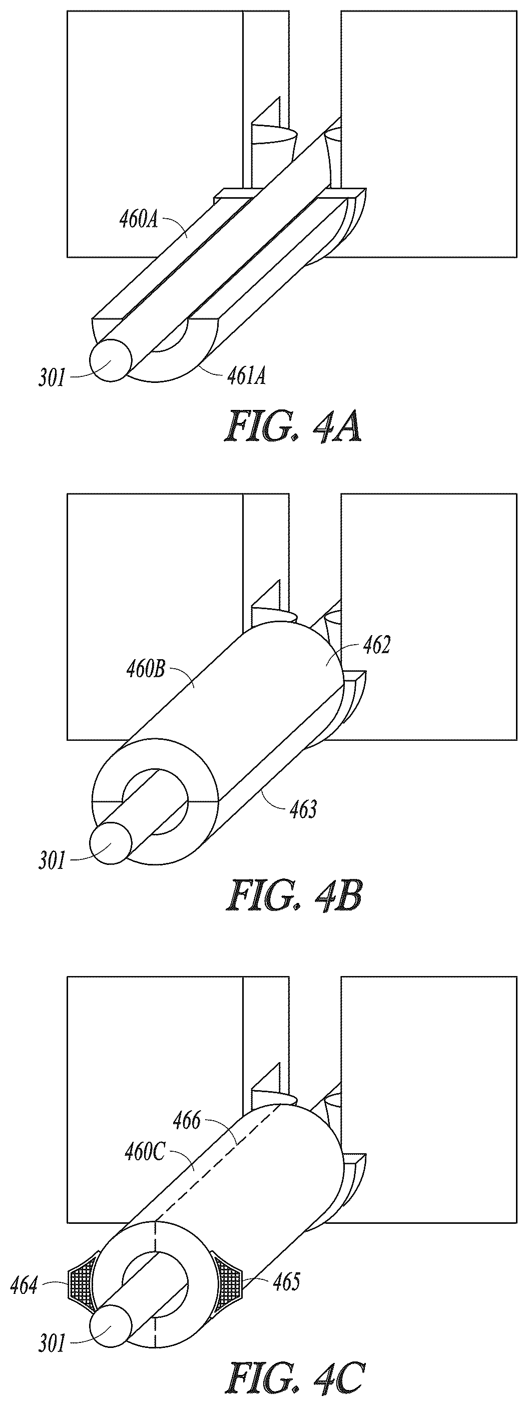 Patent US12311173 Figure 4 – Modular implant delivery and positioning system