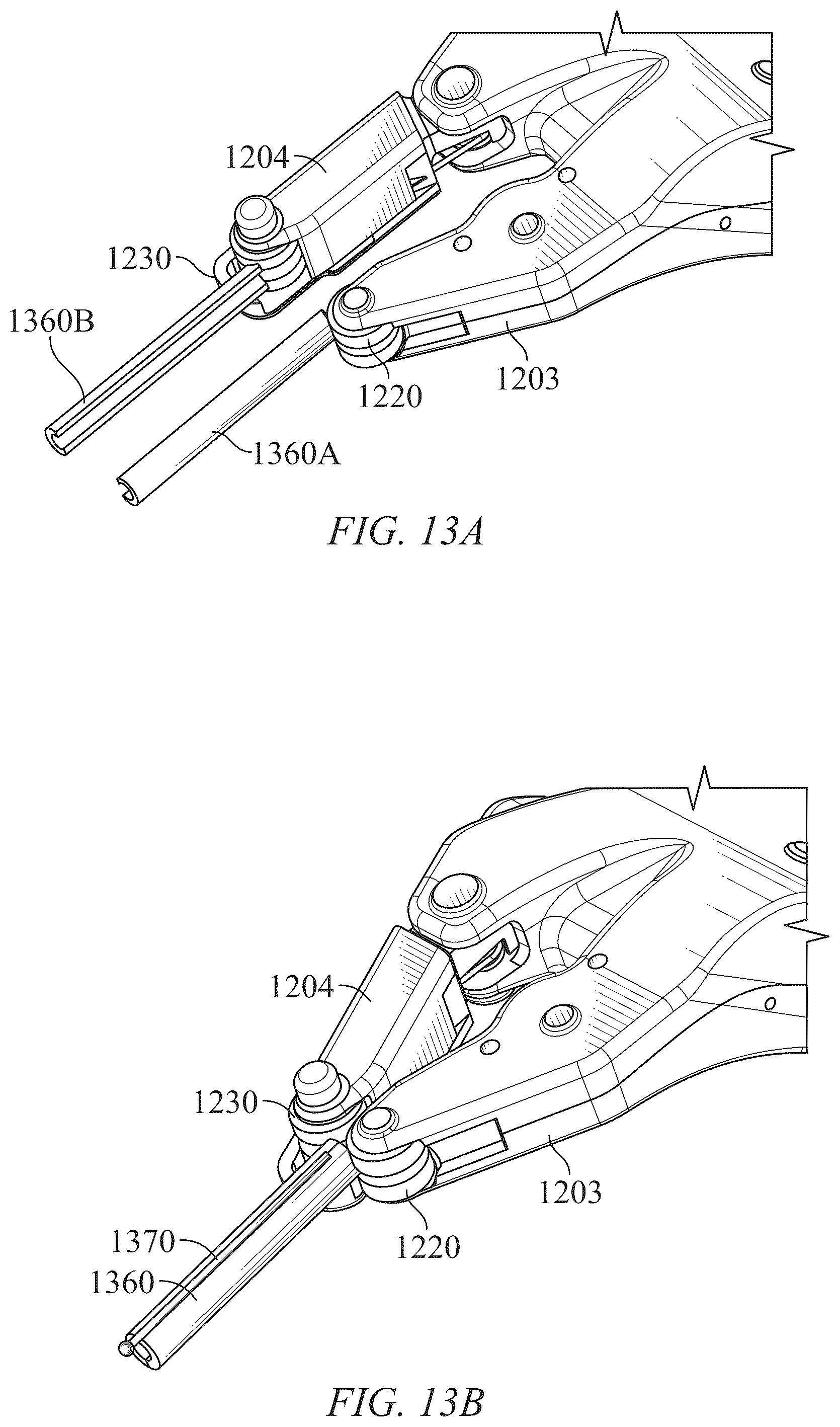 Patent US12311173 Figure 15 – Modular implant delivery and positioning system