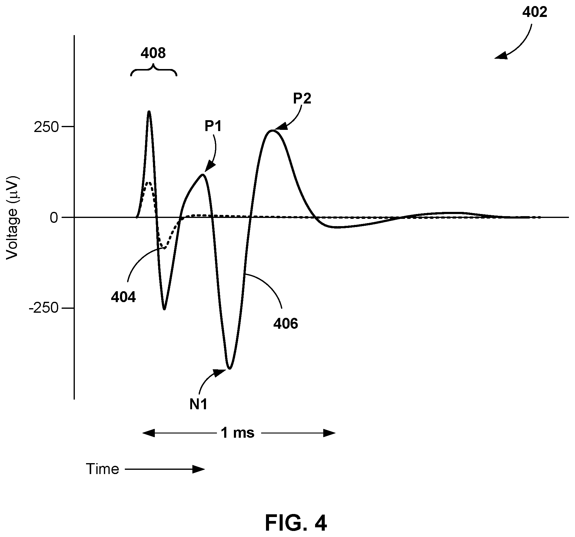 Patent US12311176 Figure 4 – Implantable lead location using ECAP