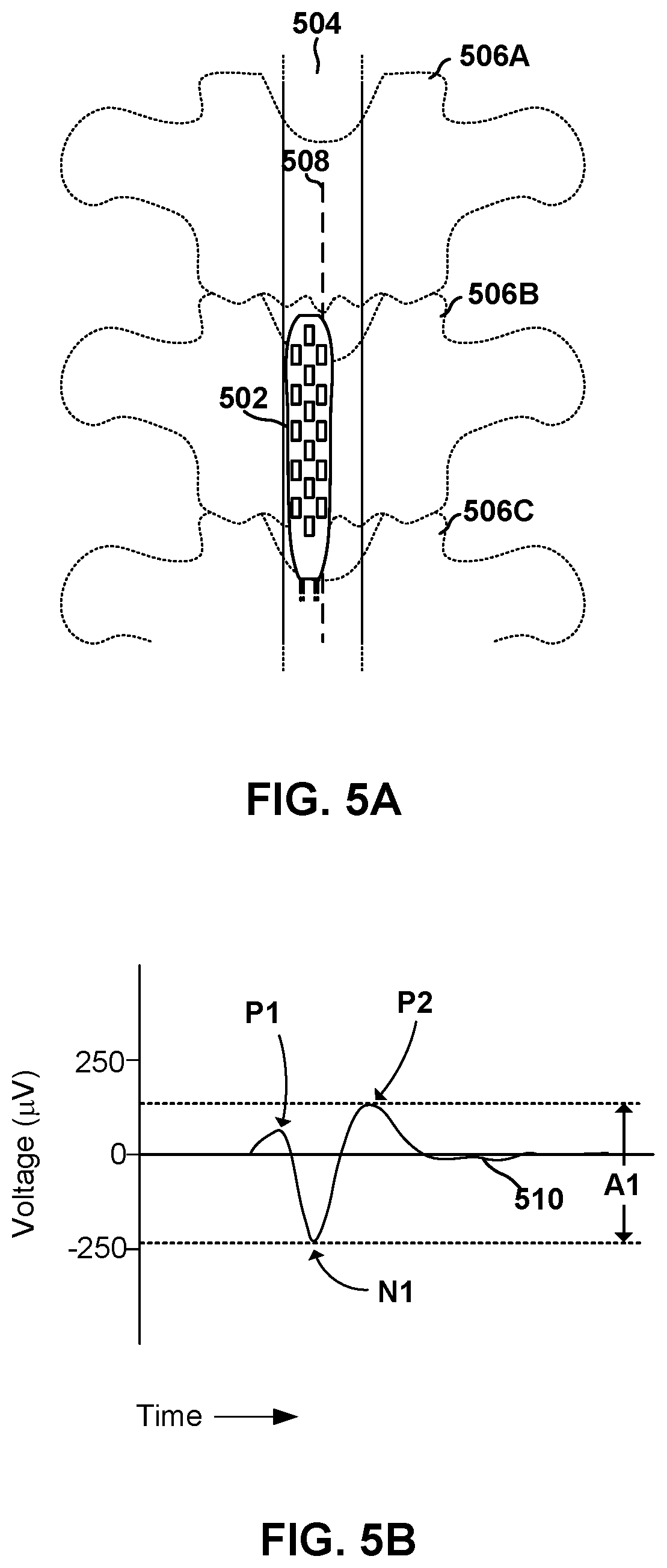 Patent US12311176 Figure 5 – Implantable lead location using ECAP