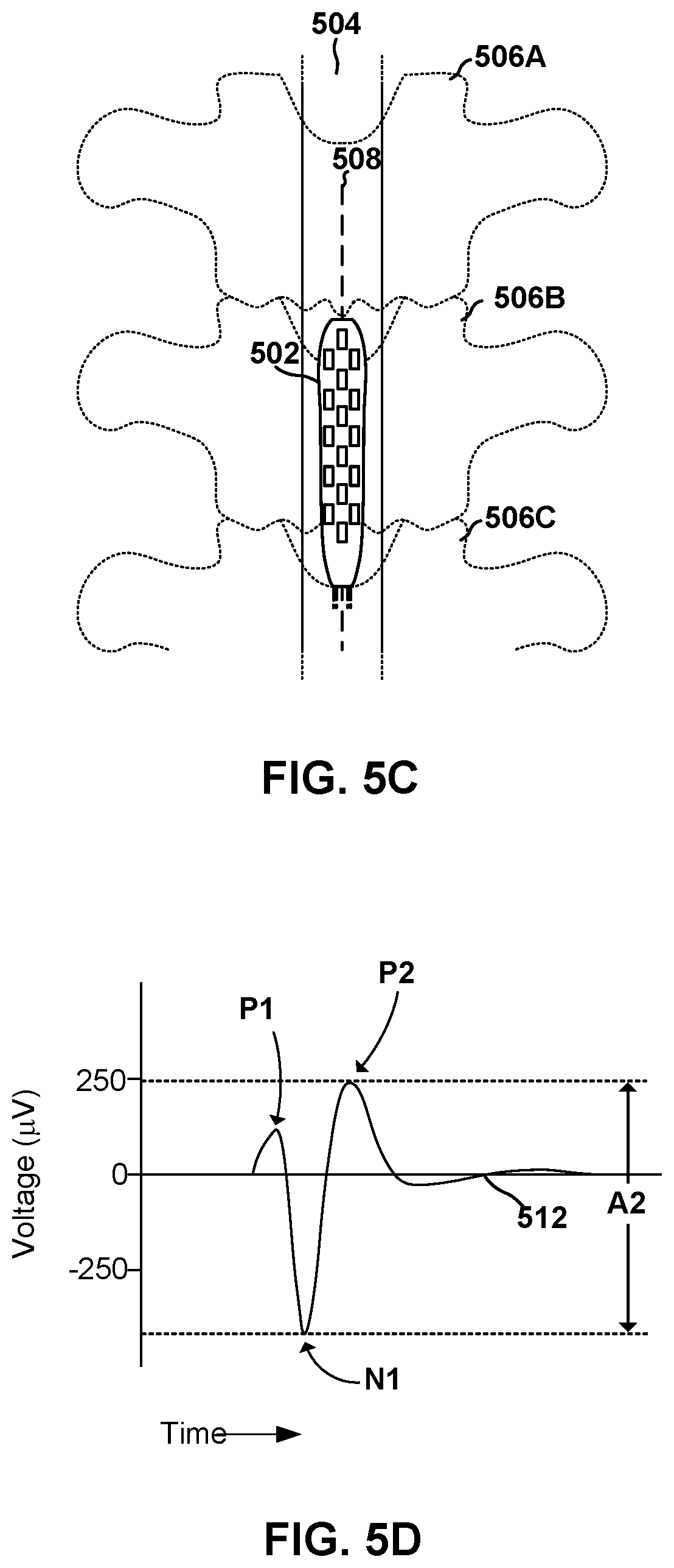 Patent US12311176 Figure 6 – Implantable lead location using ECAP
