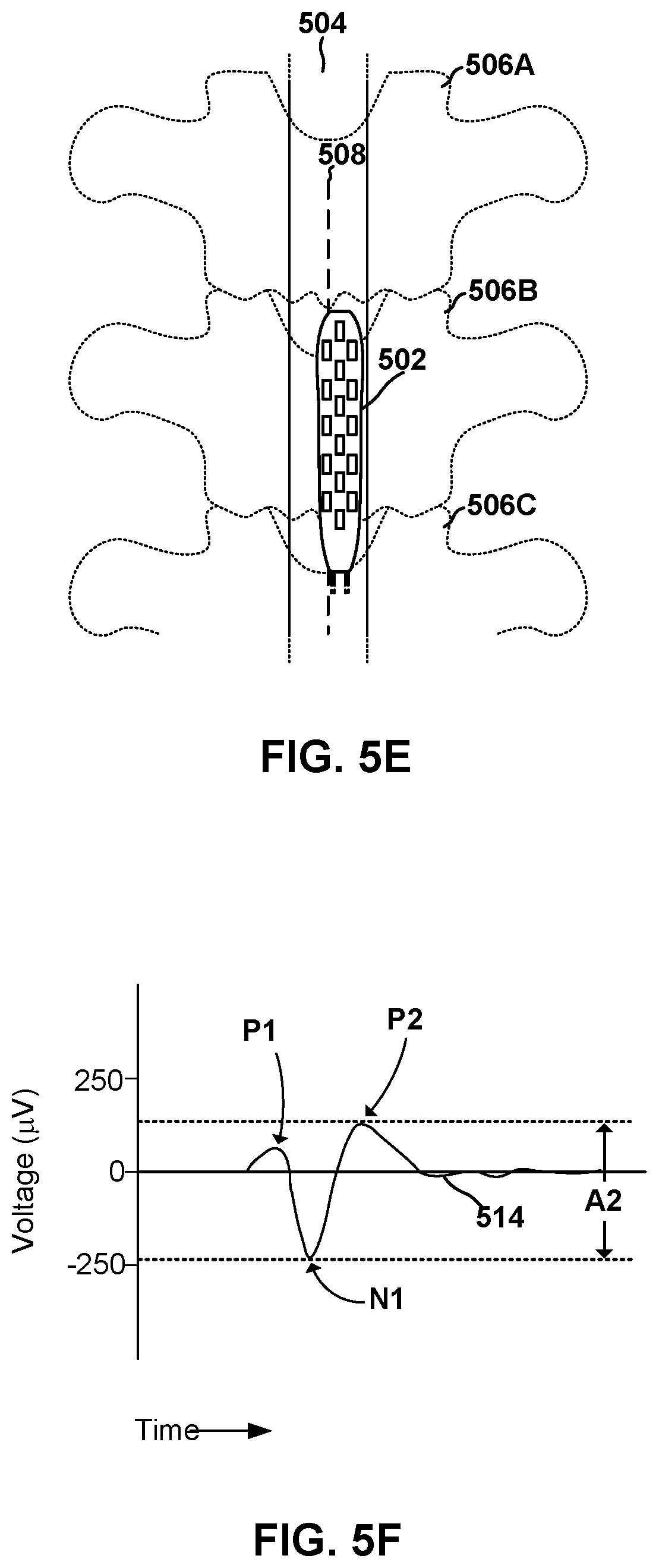 Patent US12311176 Figure 7 – Implantable lead location using ECAP