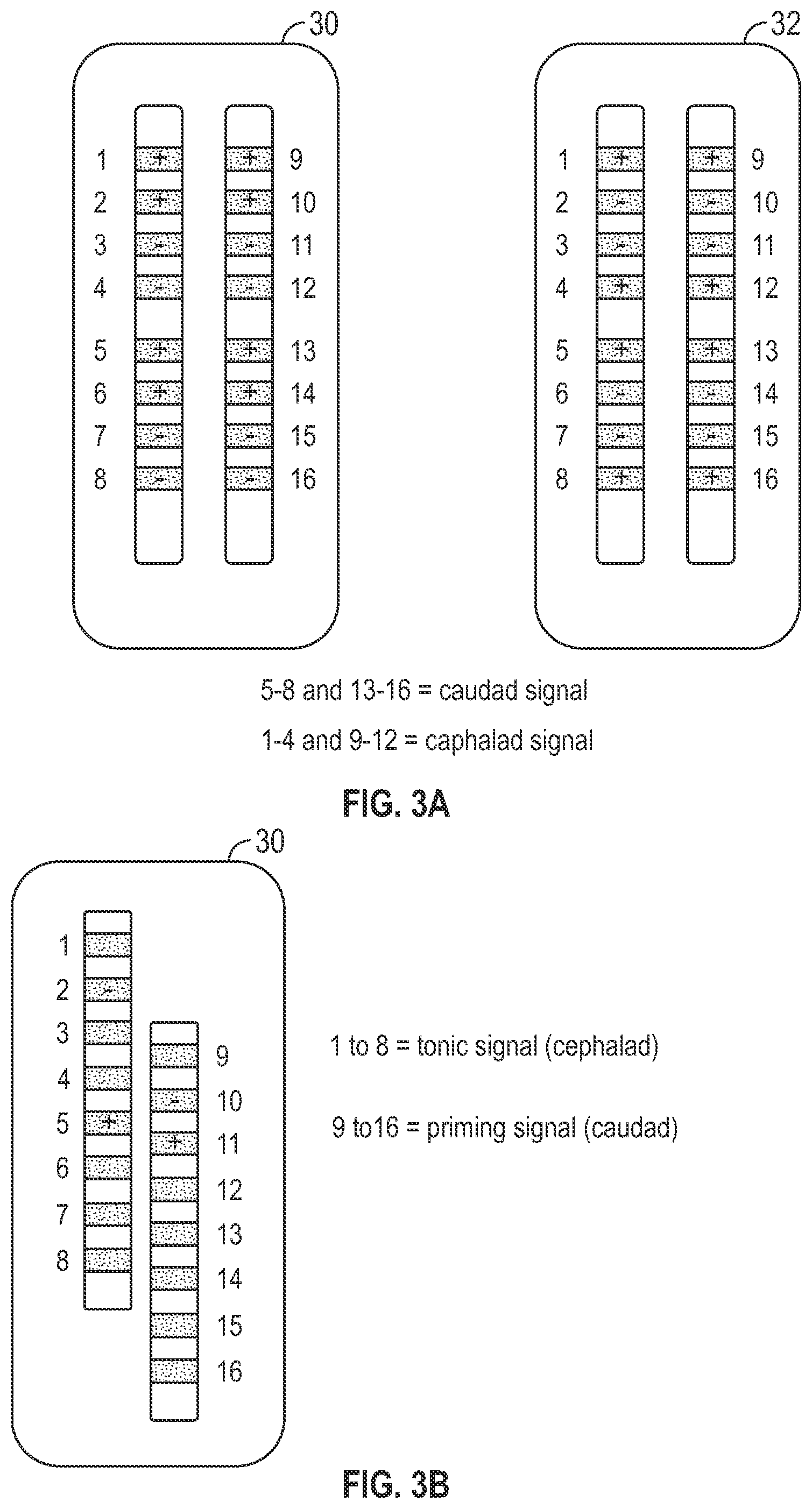 Patent US12311177 Figure 3 – Method and apparatus for multi modal electrical modulation of pain using composite electromagnetic fields