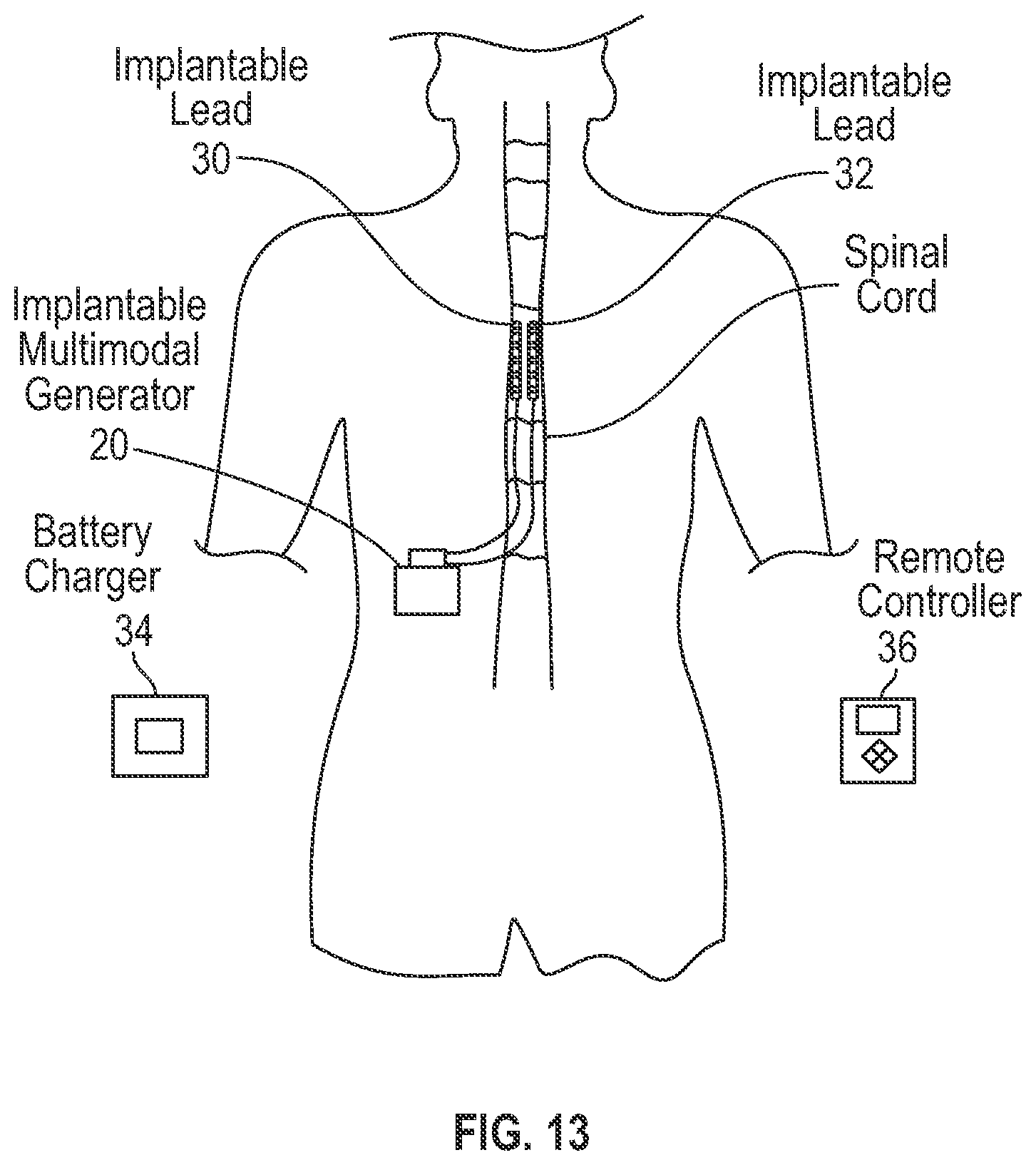 Patent US12311177 Figure 9 – Method and apparatus for multi modal electrical modulation of pain using composite electromagnetic fields