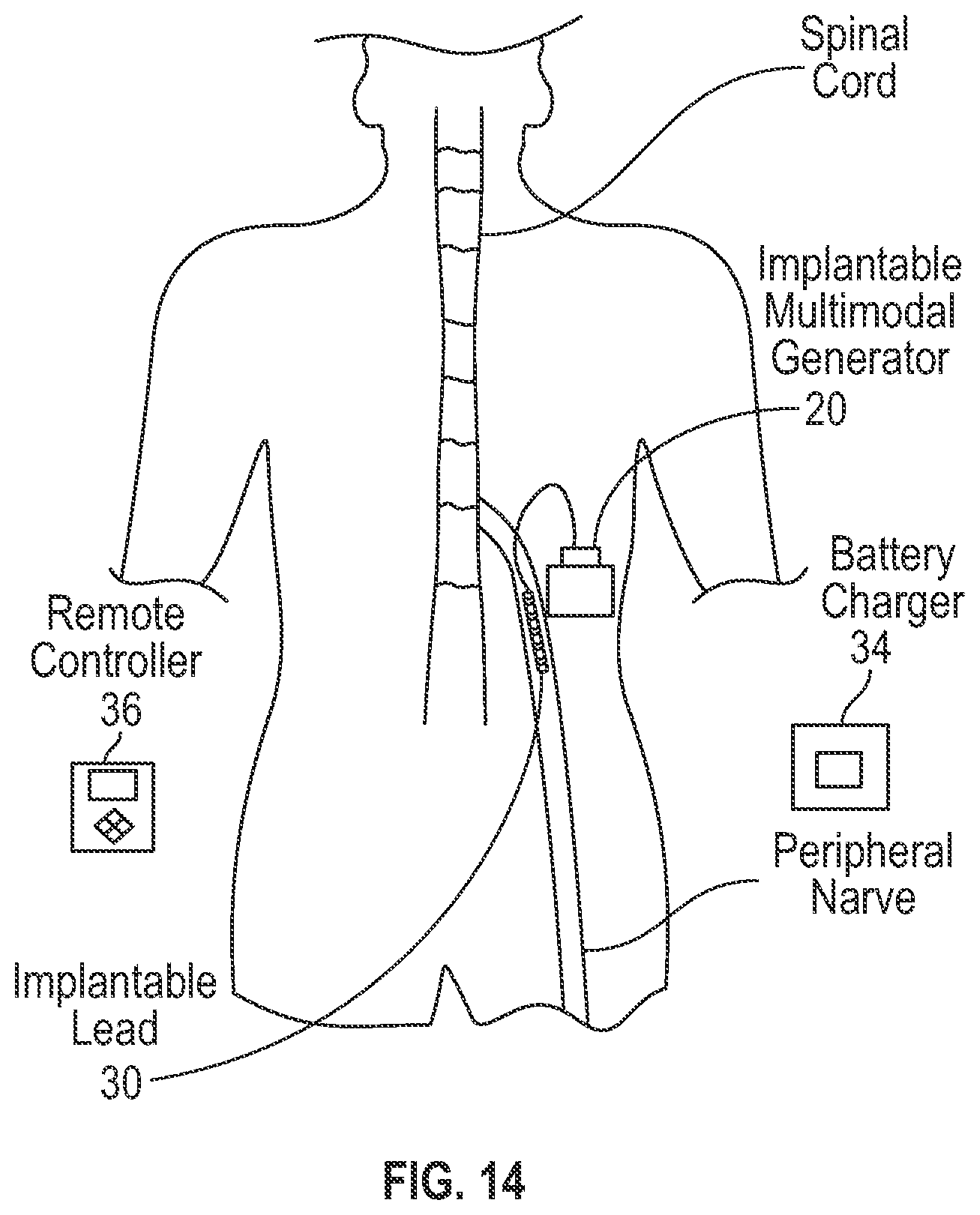 Patent US12311177 Figure 10 – Method and apparatus for multi modal electrical modulation of pain using composite electromagnetic fields