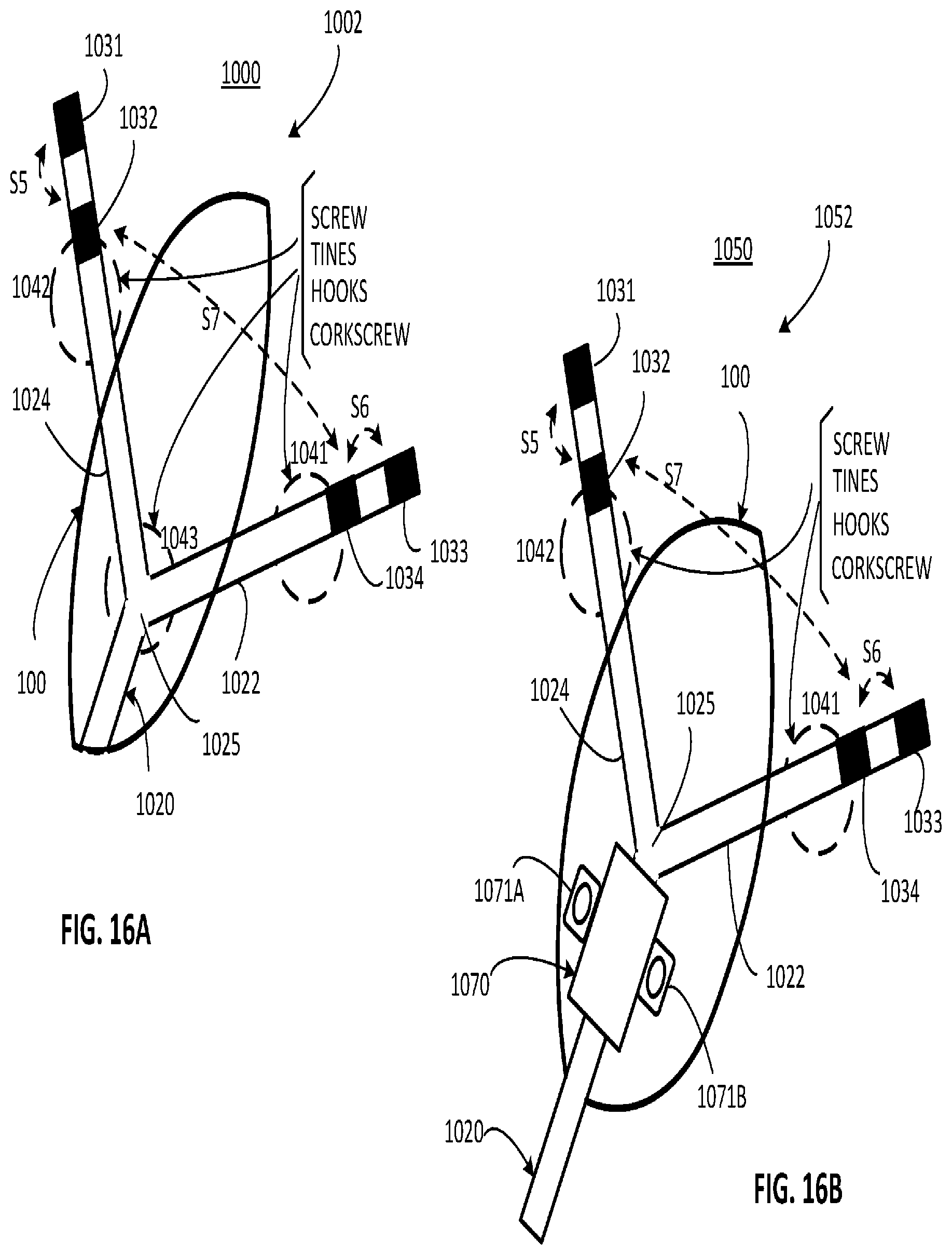 Patent US12311179 Figure 13 – Implant-access incision and sensing for sleep disordered breathing (SDB) care