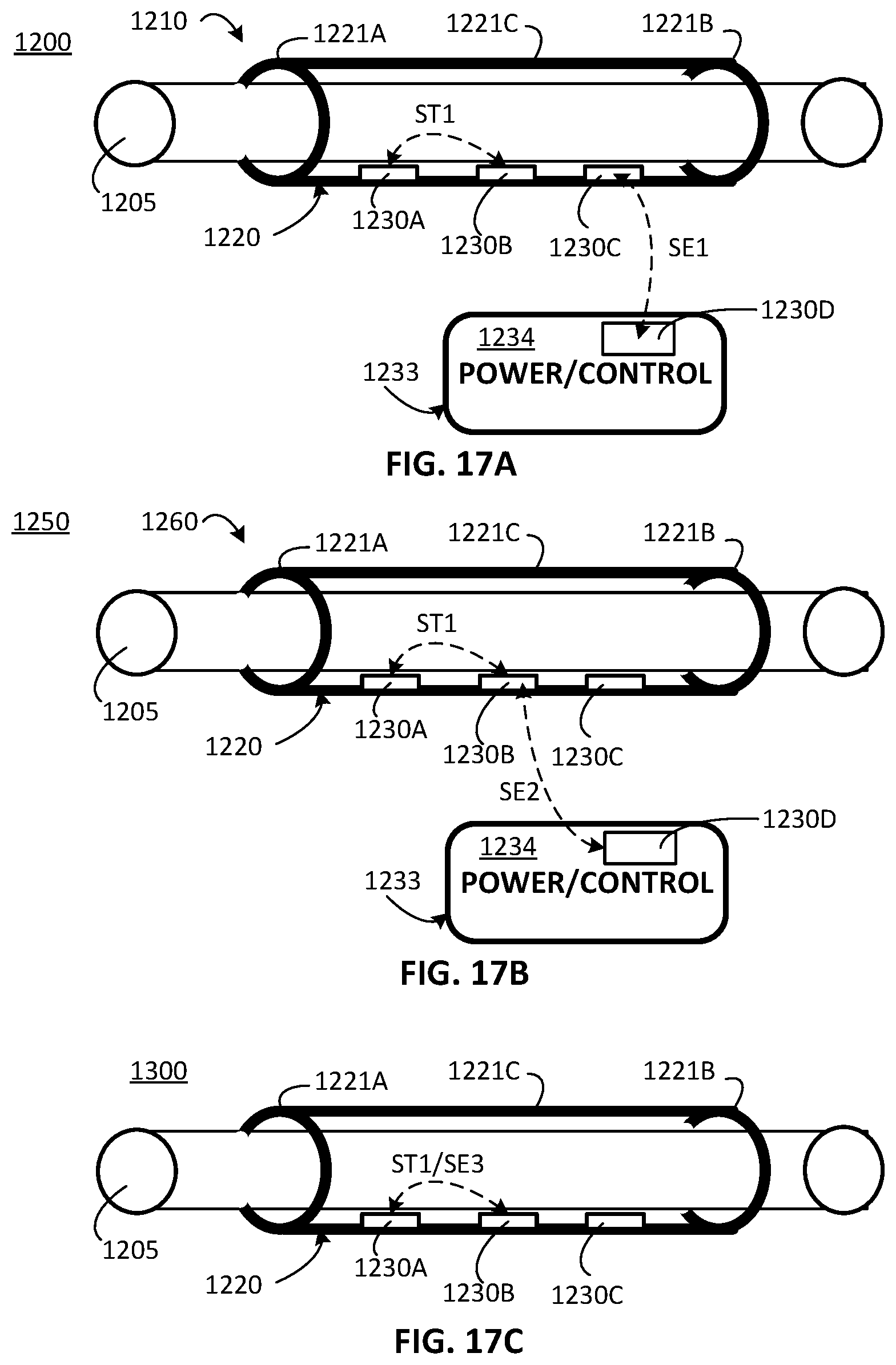 Patent US12311179 Figure 14 – Implant-access incision and sensing for sleep disordered breathing (SDB) care