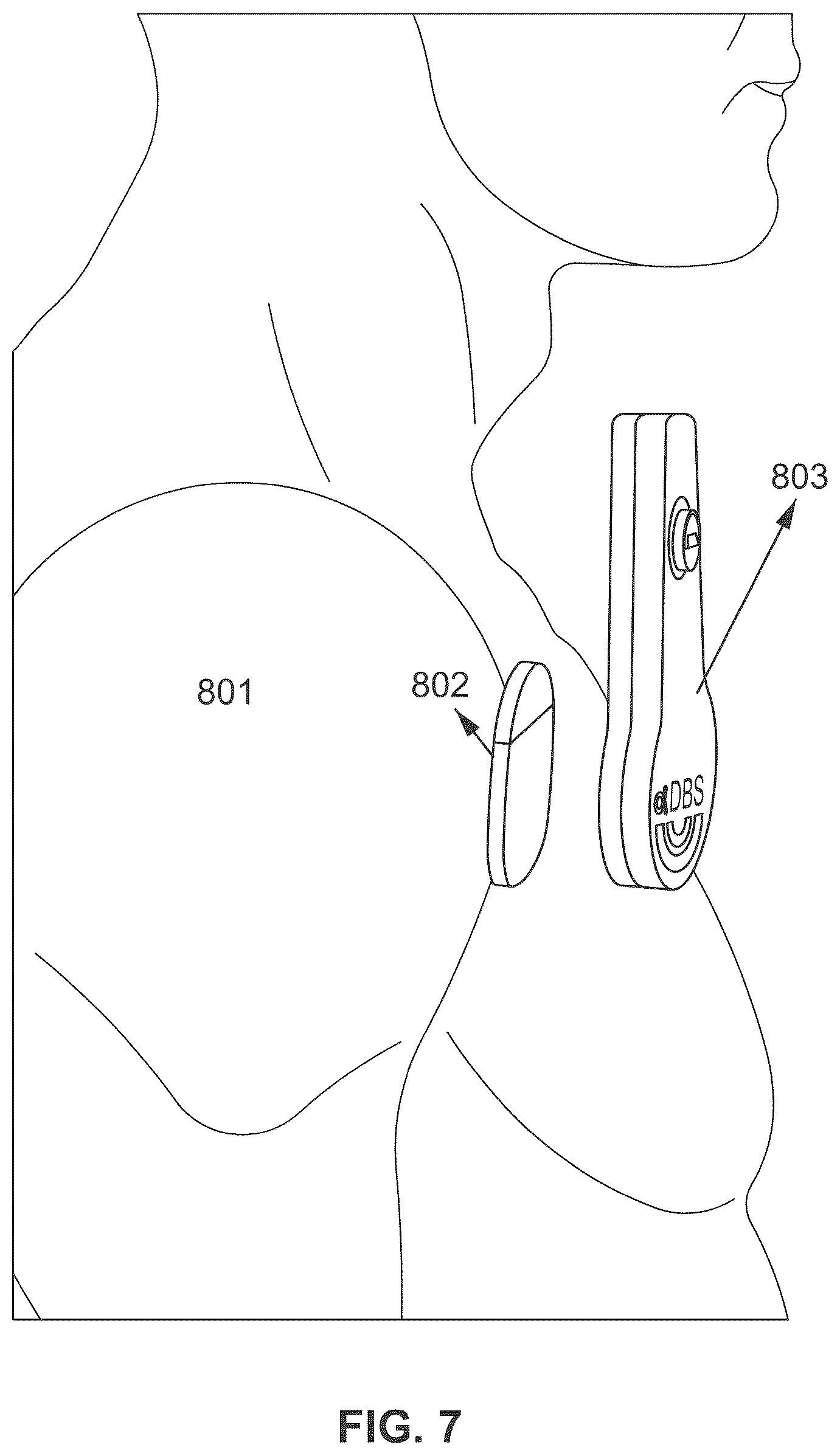Patent US12311180 Figure 8 – Systems and methods for adaptive deep brain stimulation