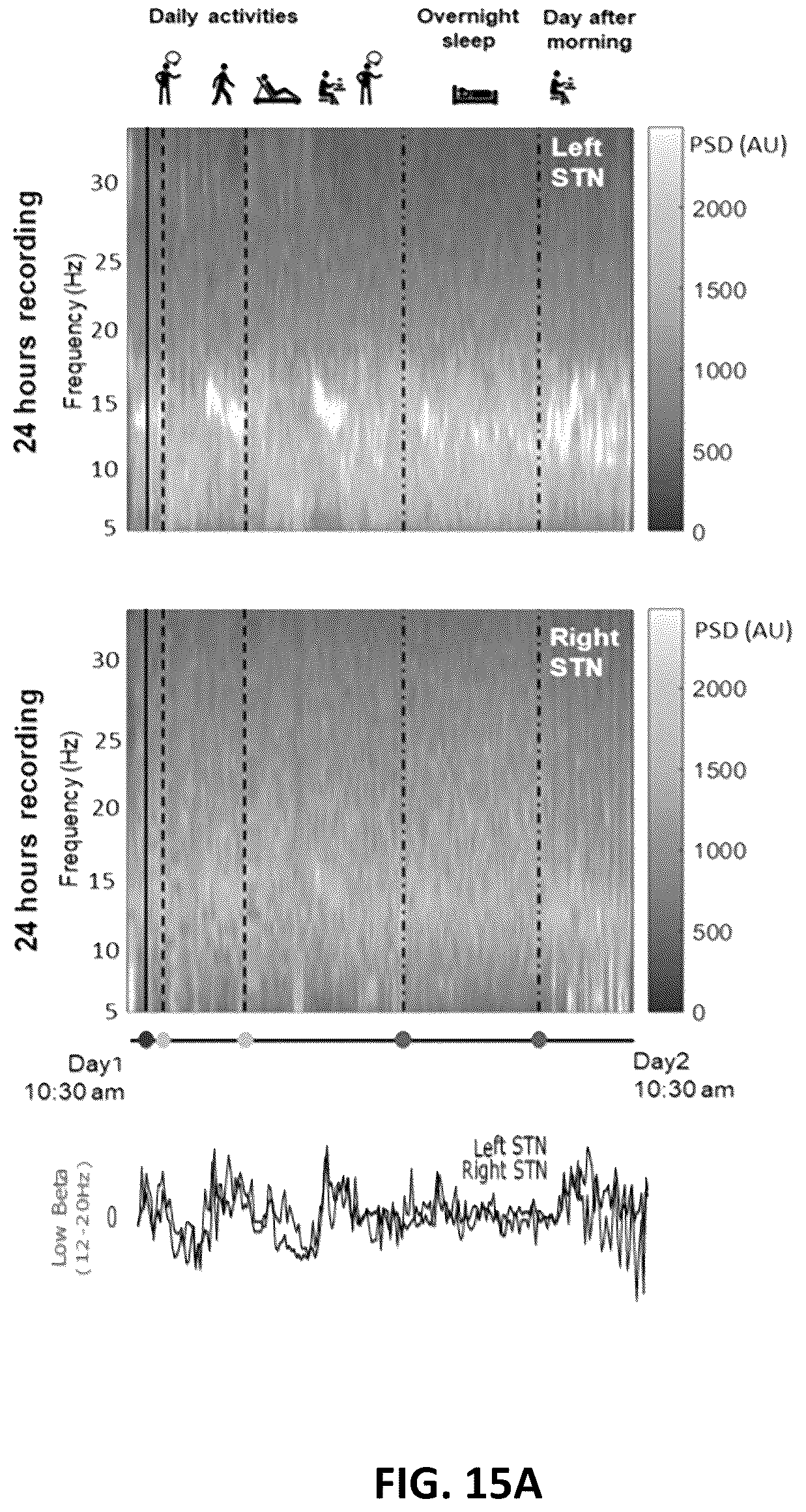 Patent US12311180 Figure 16 – Systems and methods for adaptive deep brain stimulation