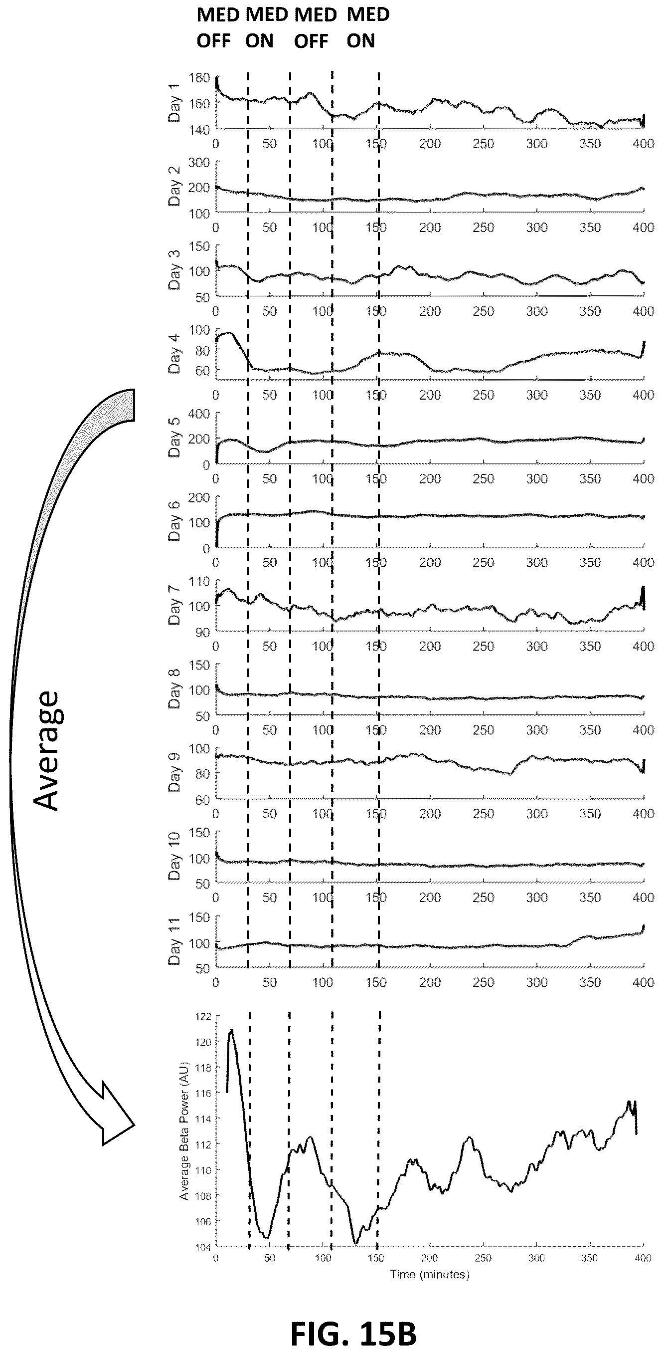Patent US12311180 Figure 17 – Systems and methods for adaptive deep brain stimulation