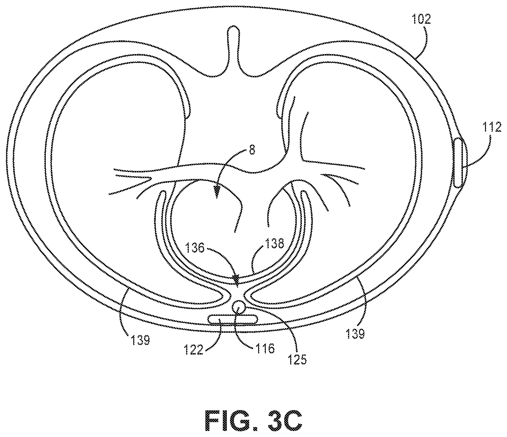Patent US12311182 Figure 6 – Device and method for atrial tachyarrhythmia detection