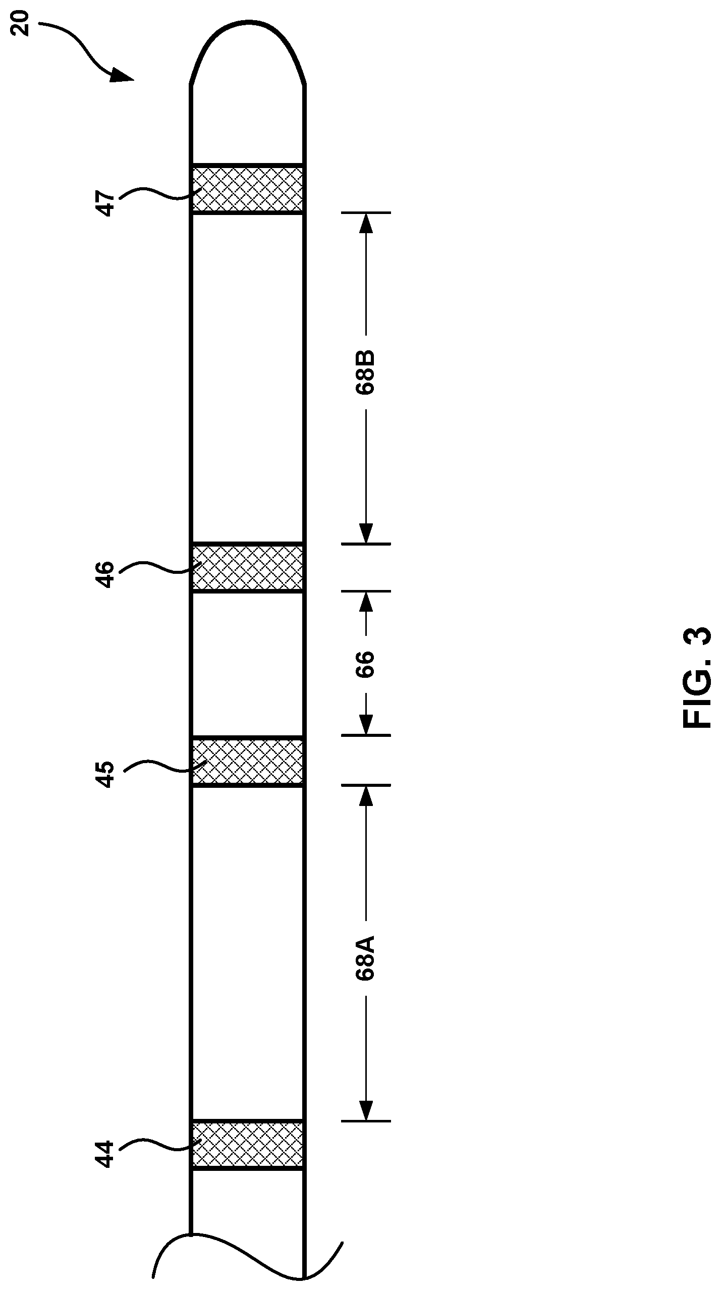 Patent US12311183 Figure 4 – Current steering for cardiac pacing