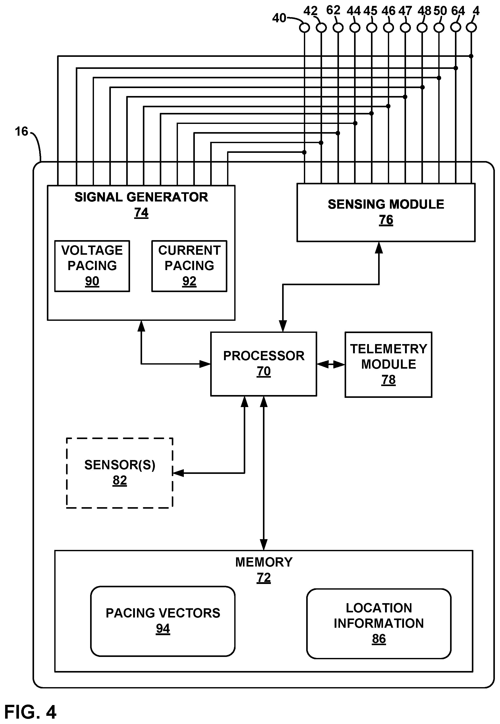 Patent US12311183 Figure 5 – Current steering for cardiac pacing