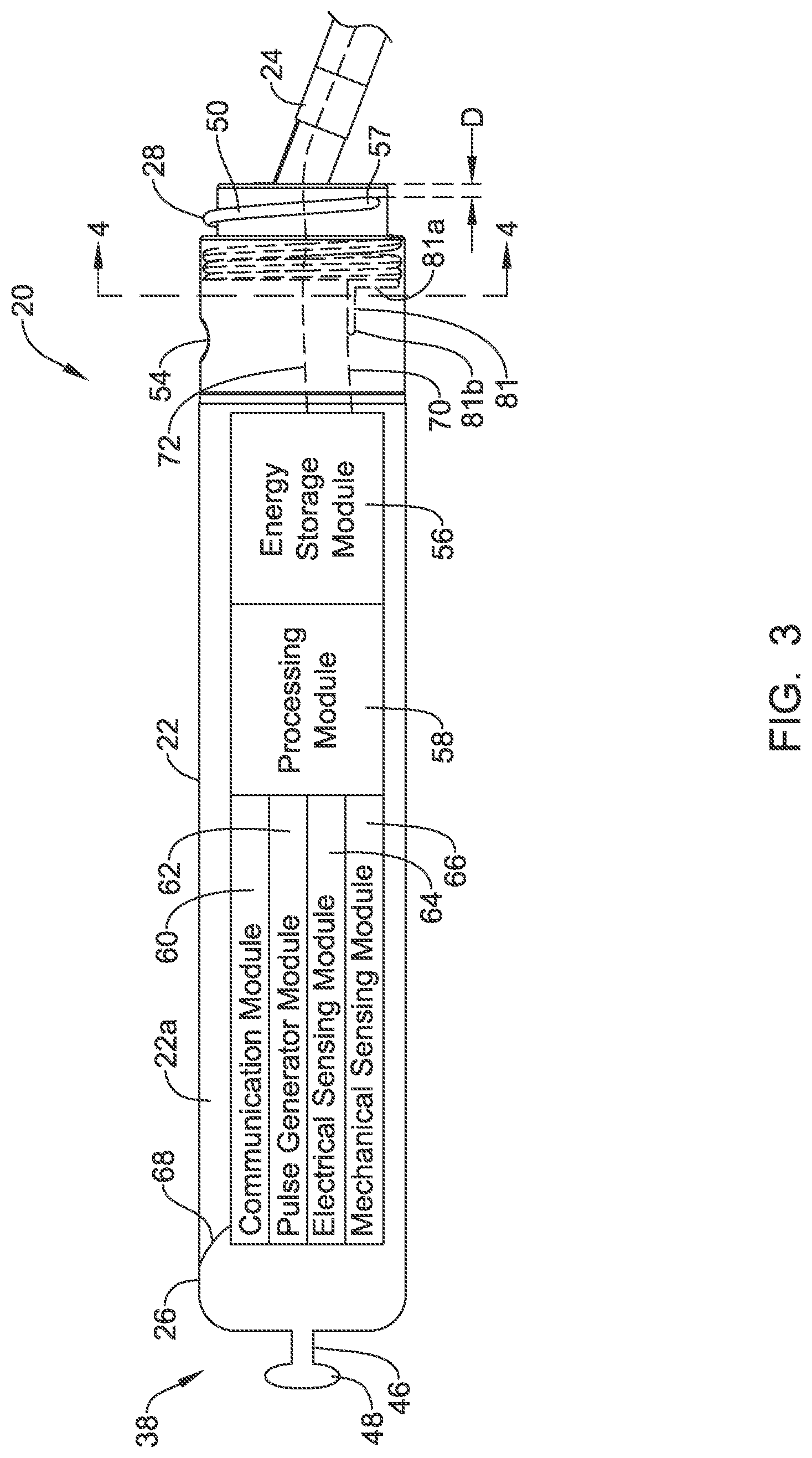 Patent US12311186 Figure 3 – Systems and methods for treating cardiac arrhythmias