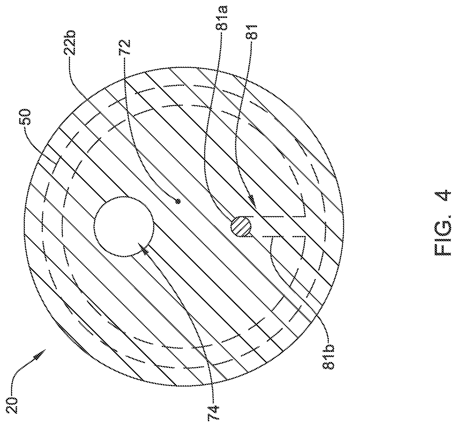 Patent US12311186 Figure 4 – Systems and methods for treating cardiac arrhythmias
