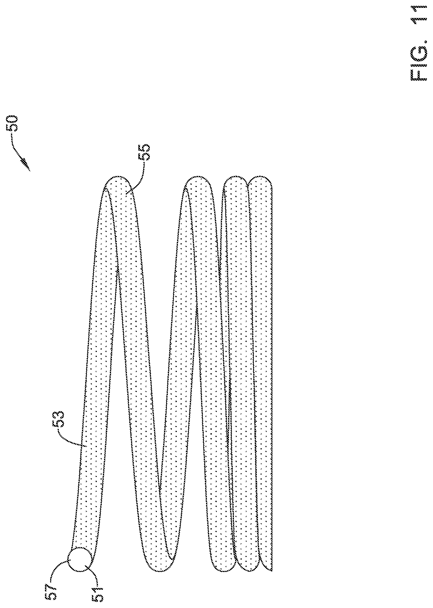 Patent US12311186 Figure 11 – Systems and methods for treating cardiac arrhythmias