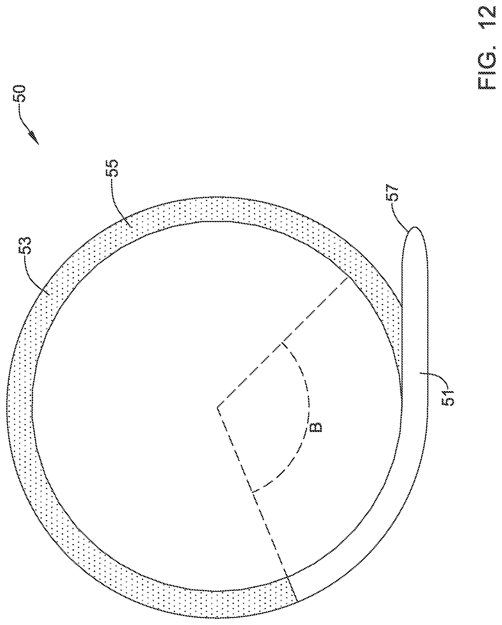 Patent US12311186 Figure 12 – Systems and methods for treating cardiac arrhythmias