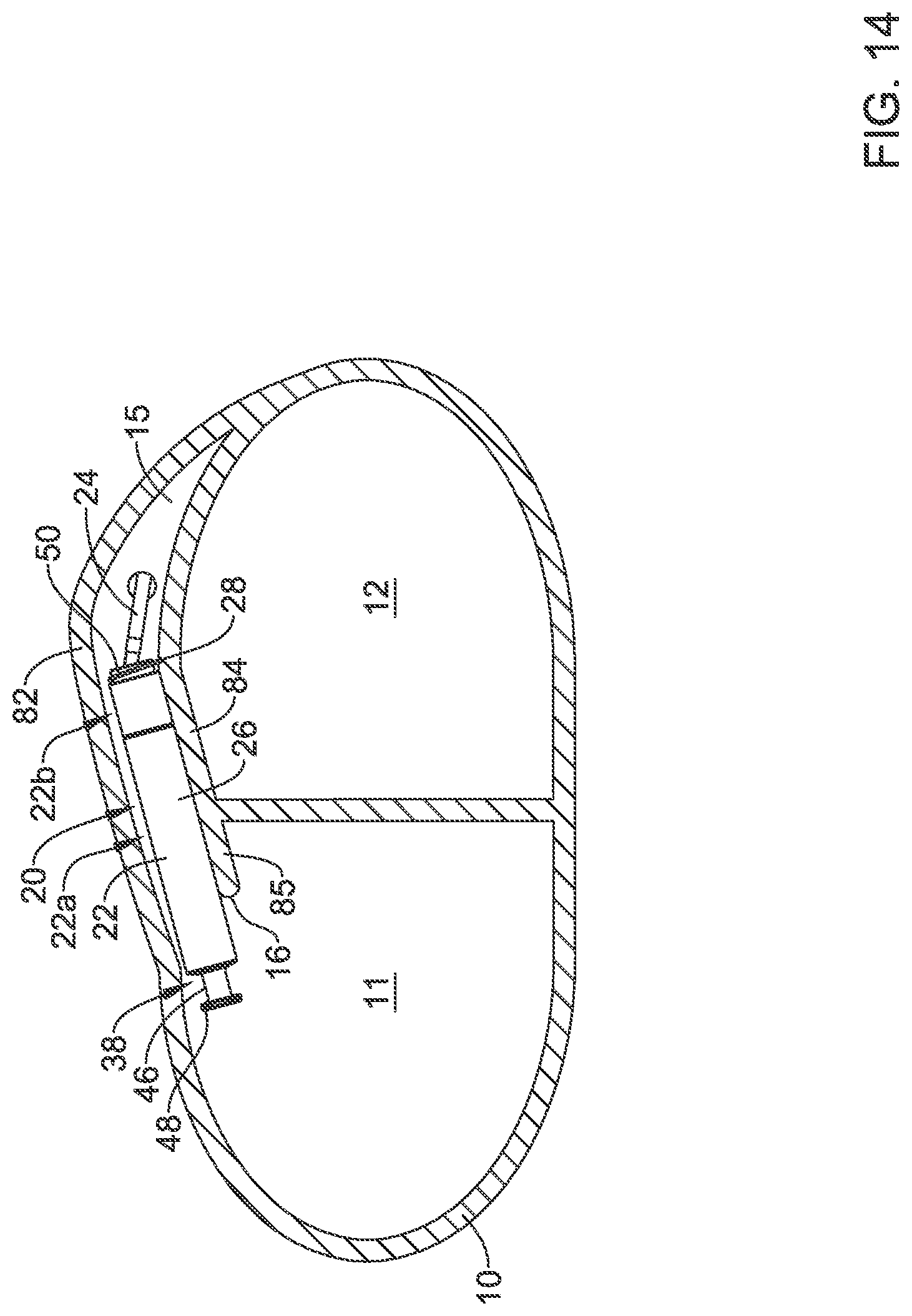 Patent US12311186 Figure 14 – Systems and methods for treating cardiac arrhythmias