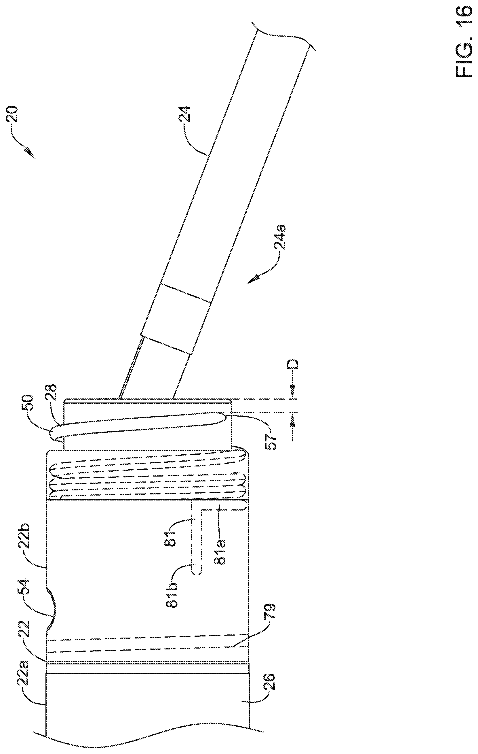 Patent US12311186 Figure 17 – Systems and methods for treating cardiac arrhythmias