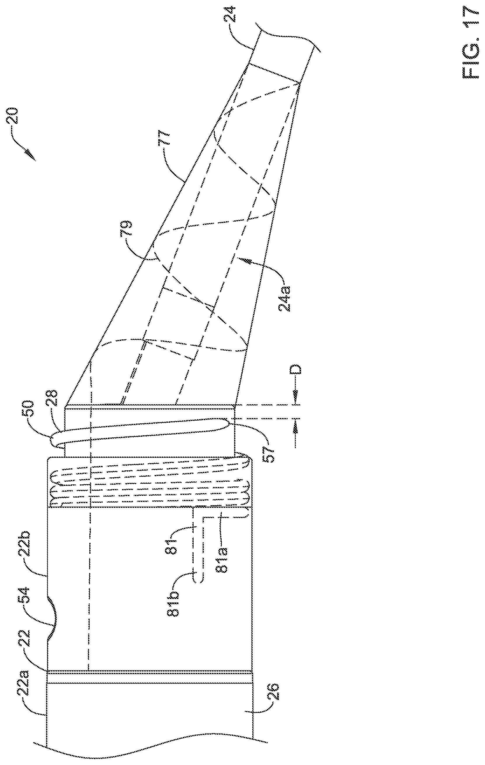 Patent US12311186 Figure 18 – Systems and methods for treating cardiac arrhythmias