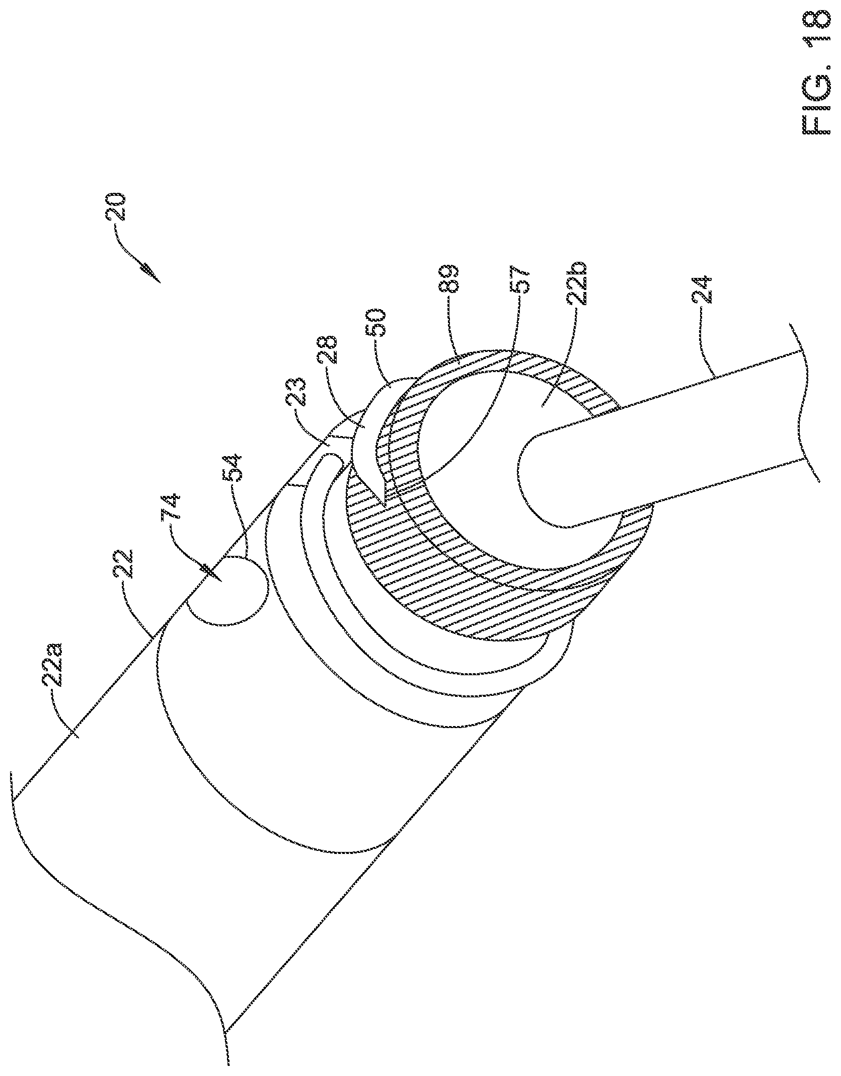 Patent US12311186 Figure 19 – Systems and methods for treating cardiac arrhythmias