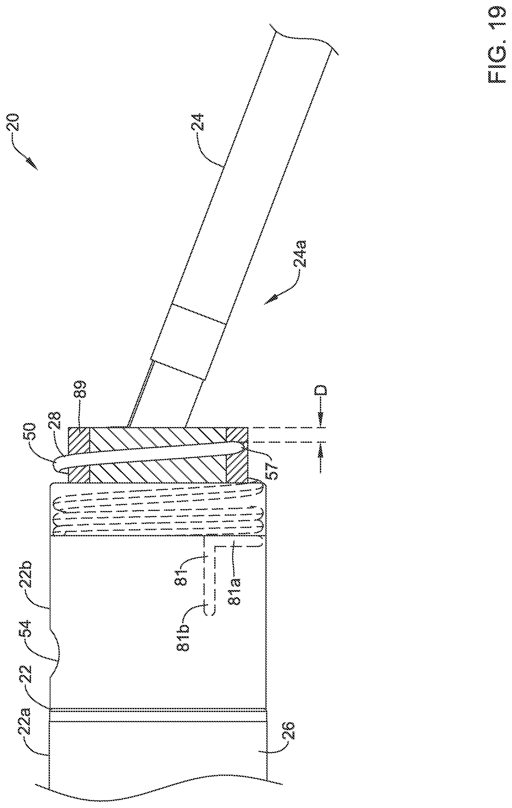 Patent US12311186 Figure 20 – Systems and methods for treating cardiac arrhythmias