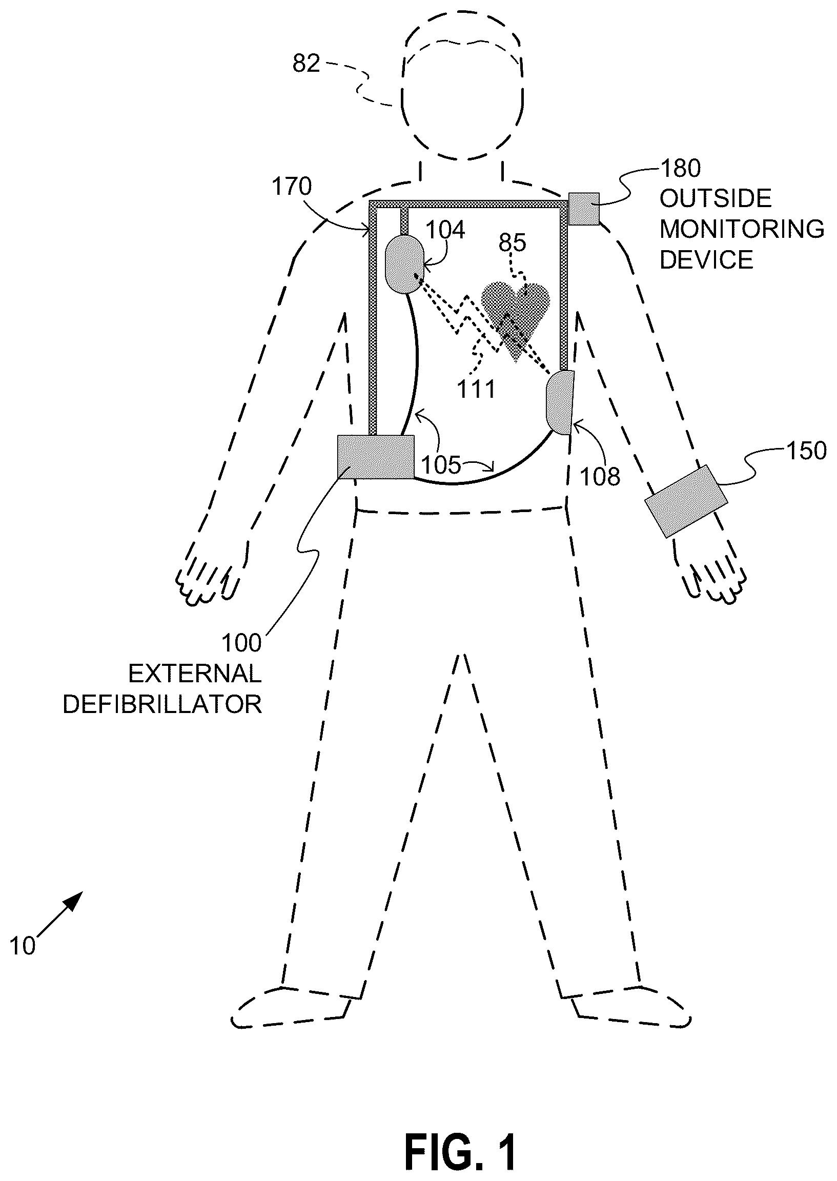 Patent US12311188 — Power in a wearable cardioverter defibrillator (WCD) — Figure 1