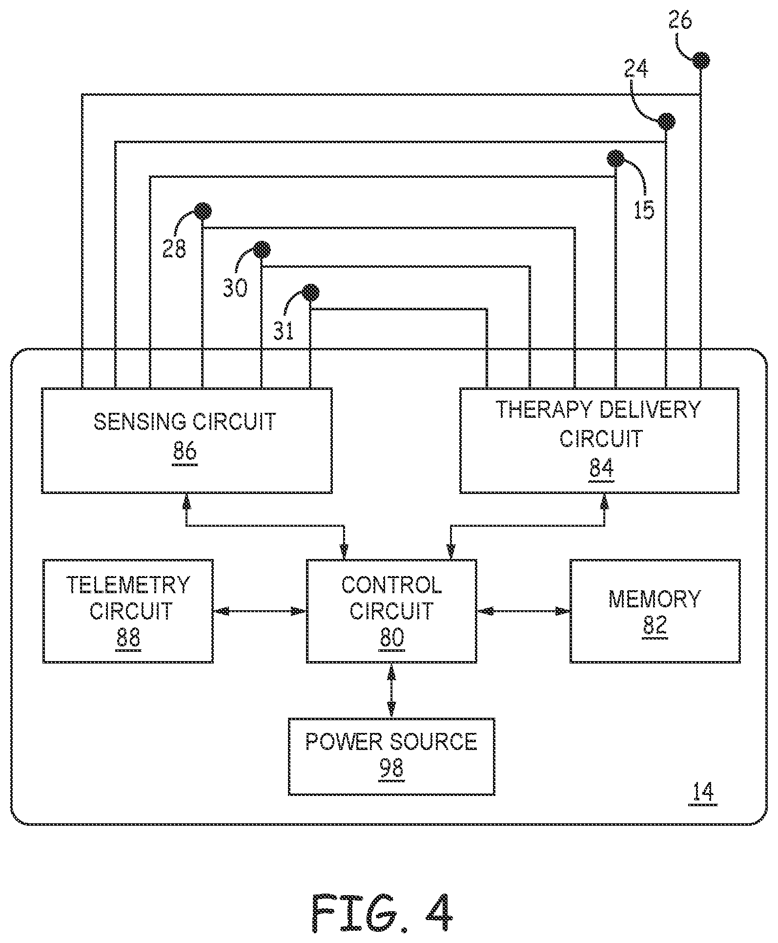 Patent US12311189 Figure 7 – Multi-threshold sensing of cardiac electrical signals in an extracardiovascular implantable cardioverter defibrillator