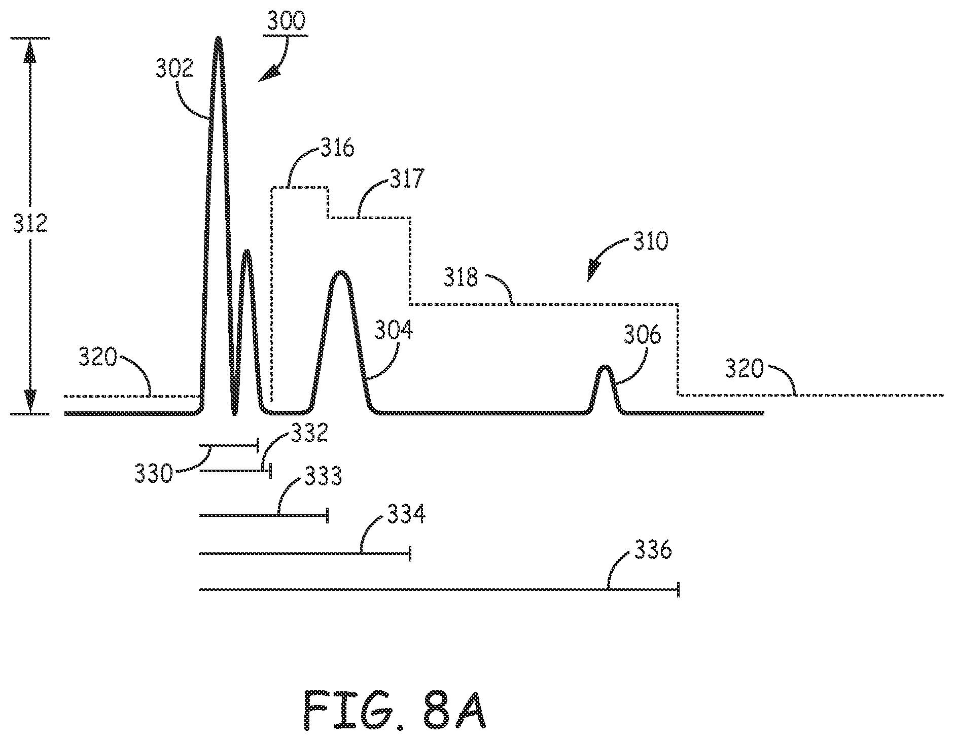 Patent US12311189 Figure 10 – Multi-threshold sensing of cardiac electrical signals in an extracardiovascular implantable cardioverter defibrillator