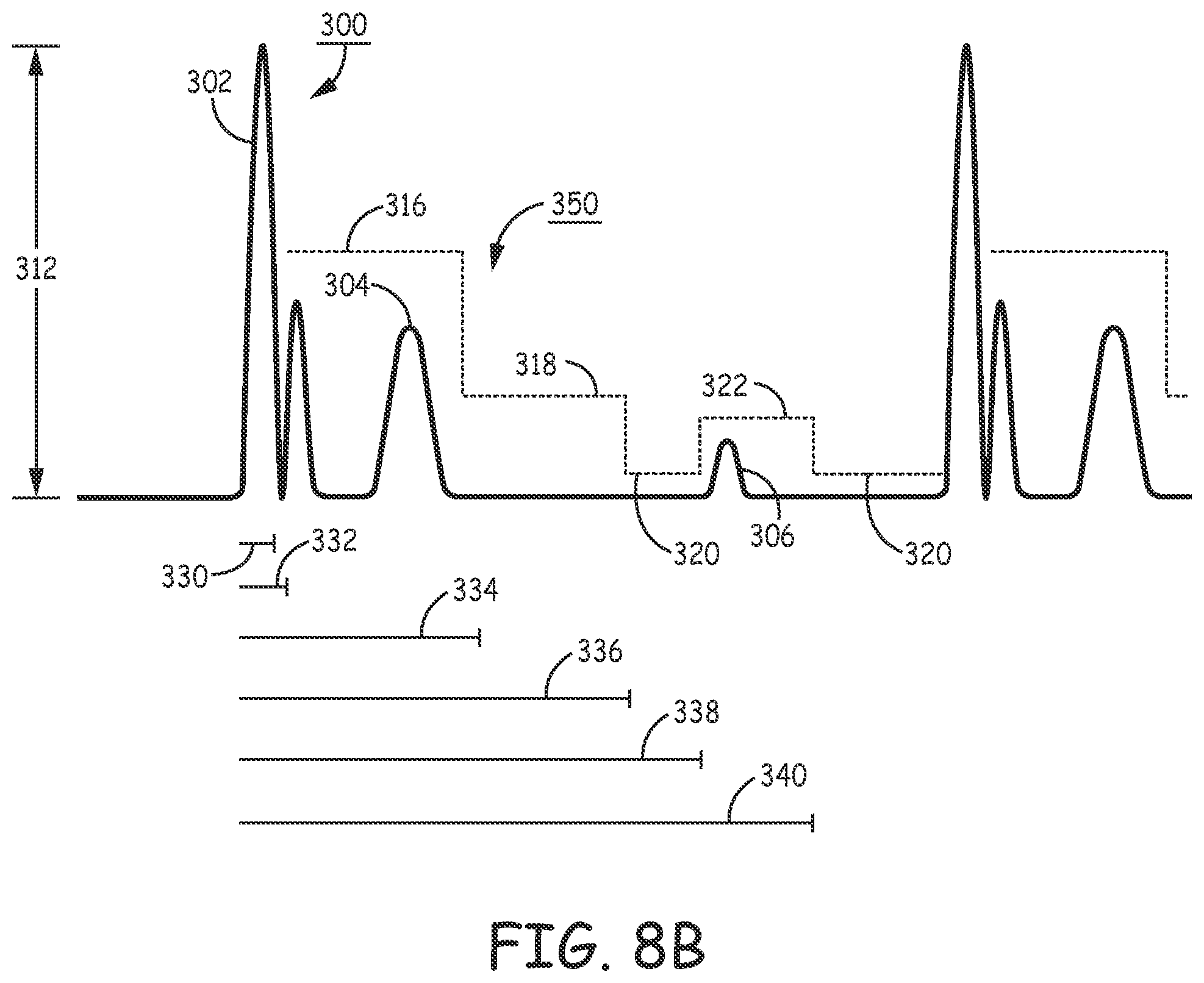 Patent US12311189 Figure 11 – Multi-threshold sensing of cardiac electrical signals in an extracardiovascular implantable cardioverter defibrillator
