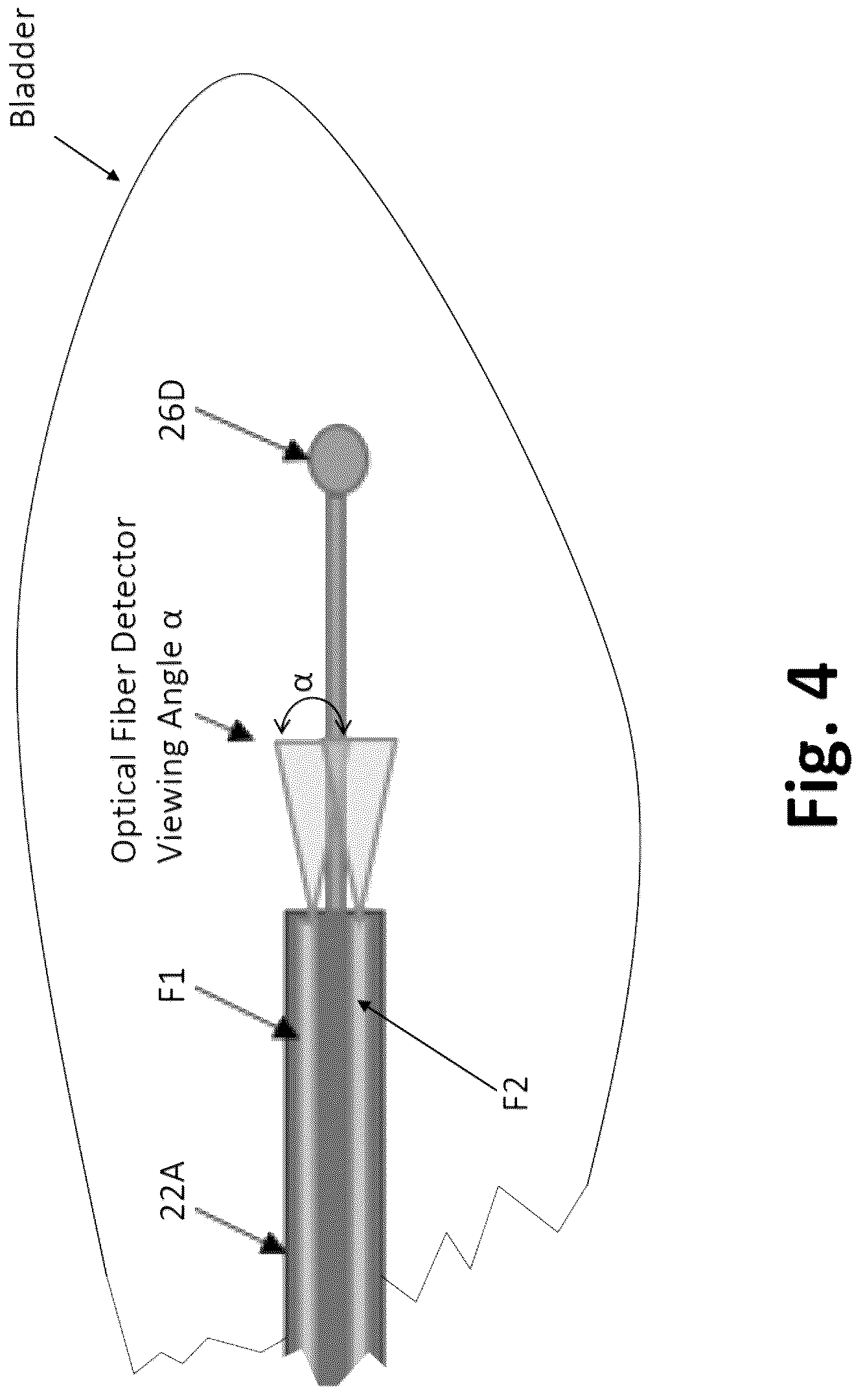 Patent US12311190 Figure 8 – Apparatus and method for irradiating inside an object