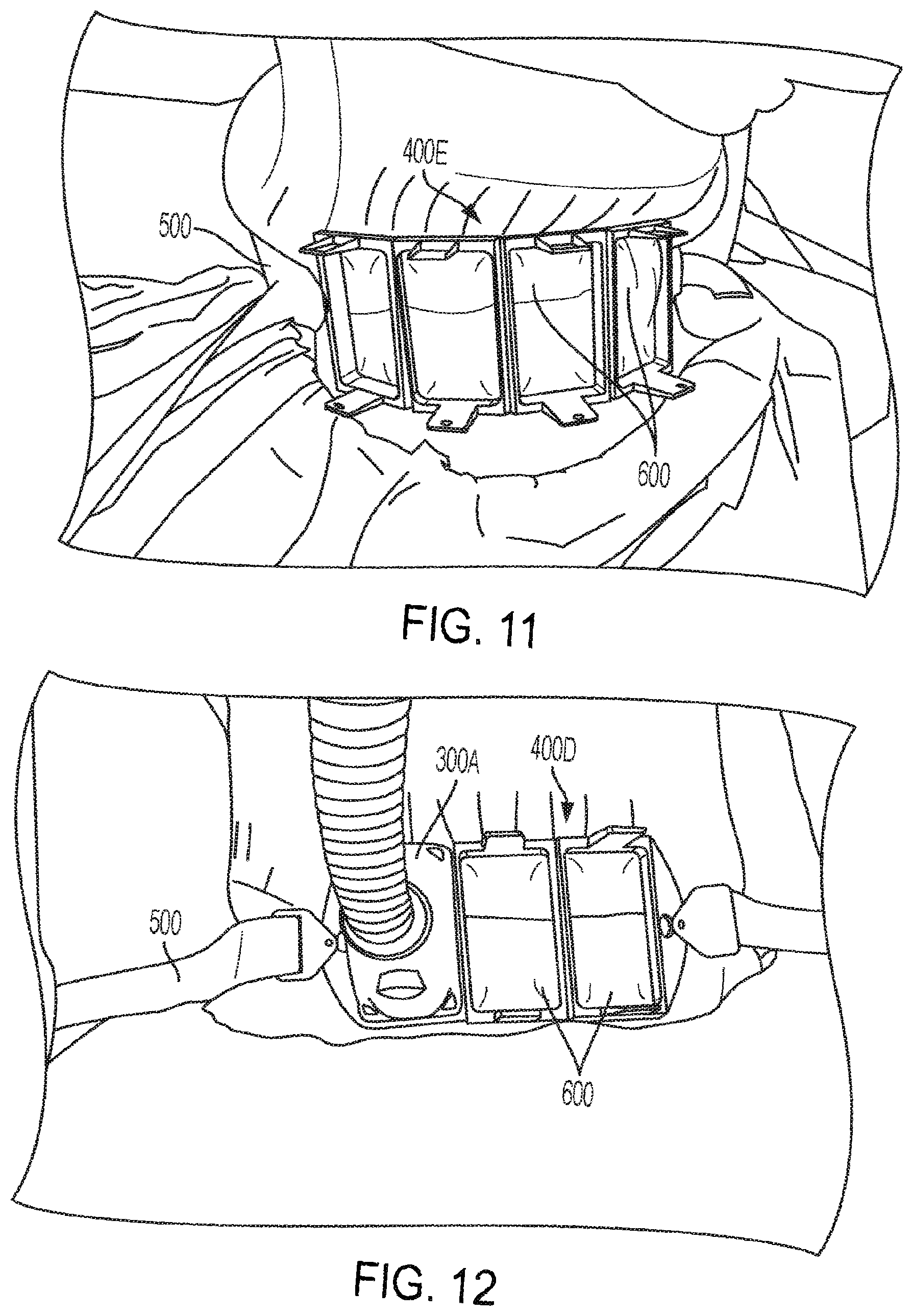 Patent US12311191 Figure 7 – System and methods of unattended treatment