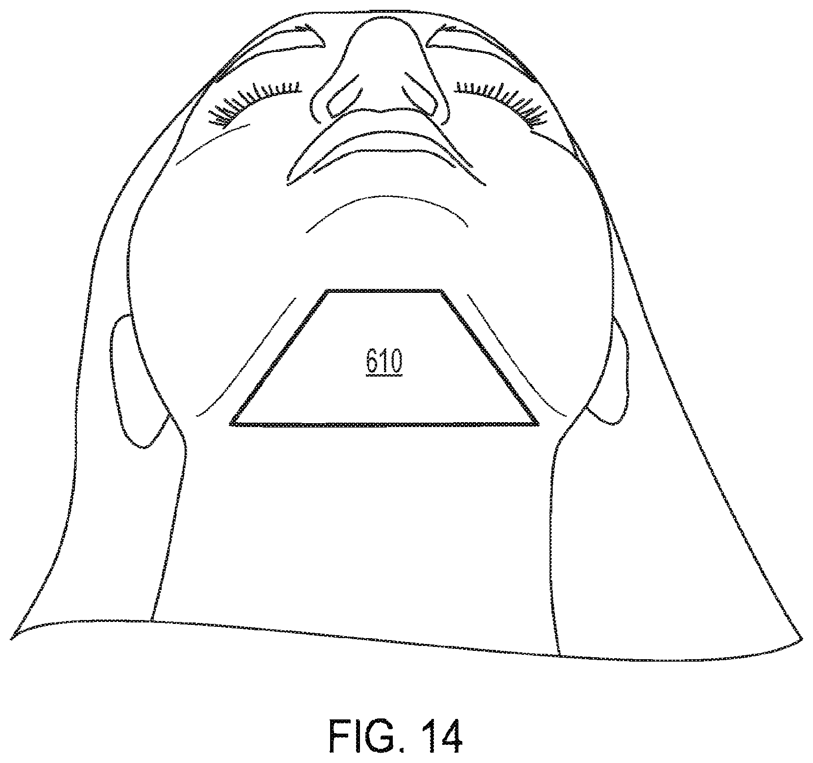 Patent US12311191 Figure 9 – System and methods of unattended treatment