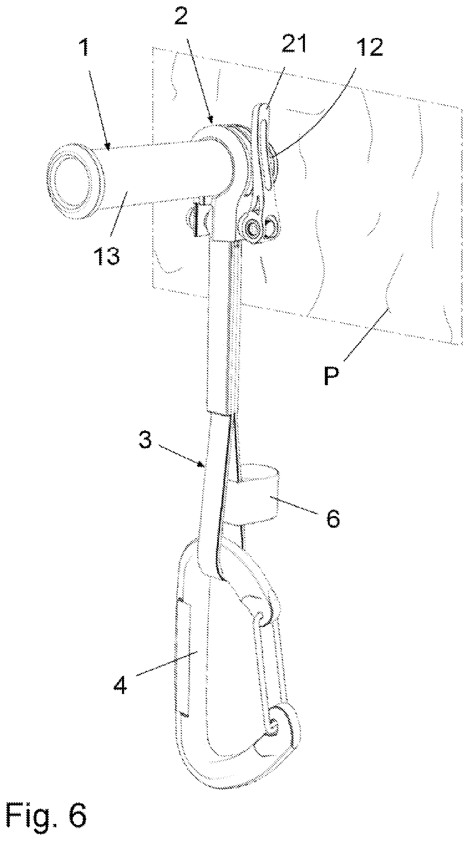 Patent US12311233 Figure 6 – Threaded anchor for ice climbing