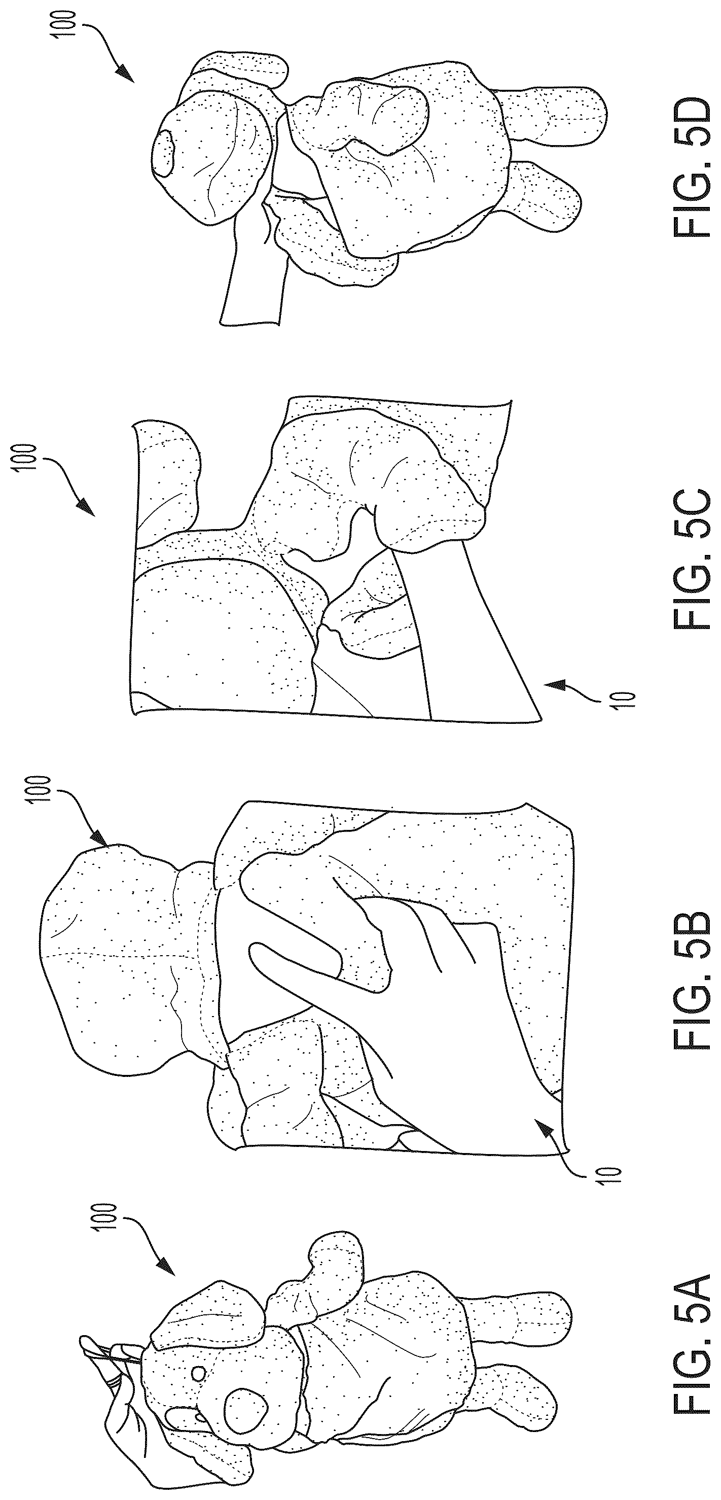 Patent US12311279 Figure 6 – Methods and apparatus for stuffable plush toy