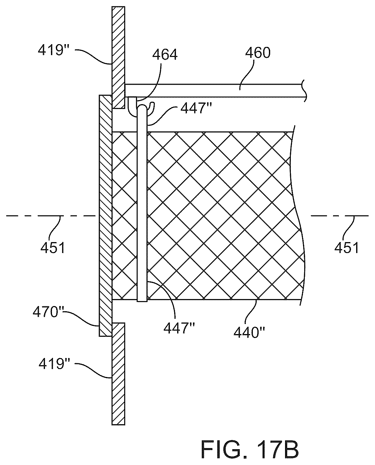 Patent US12311302 Figure 15 – Enlarged opening filter bags, support assemblies, and filter bag assemblies