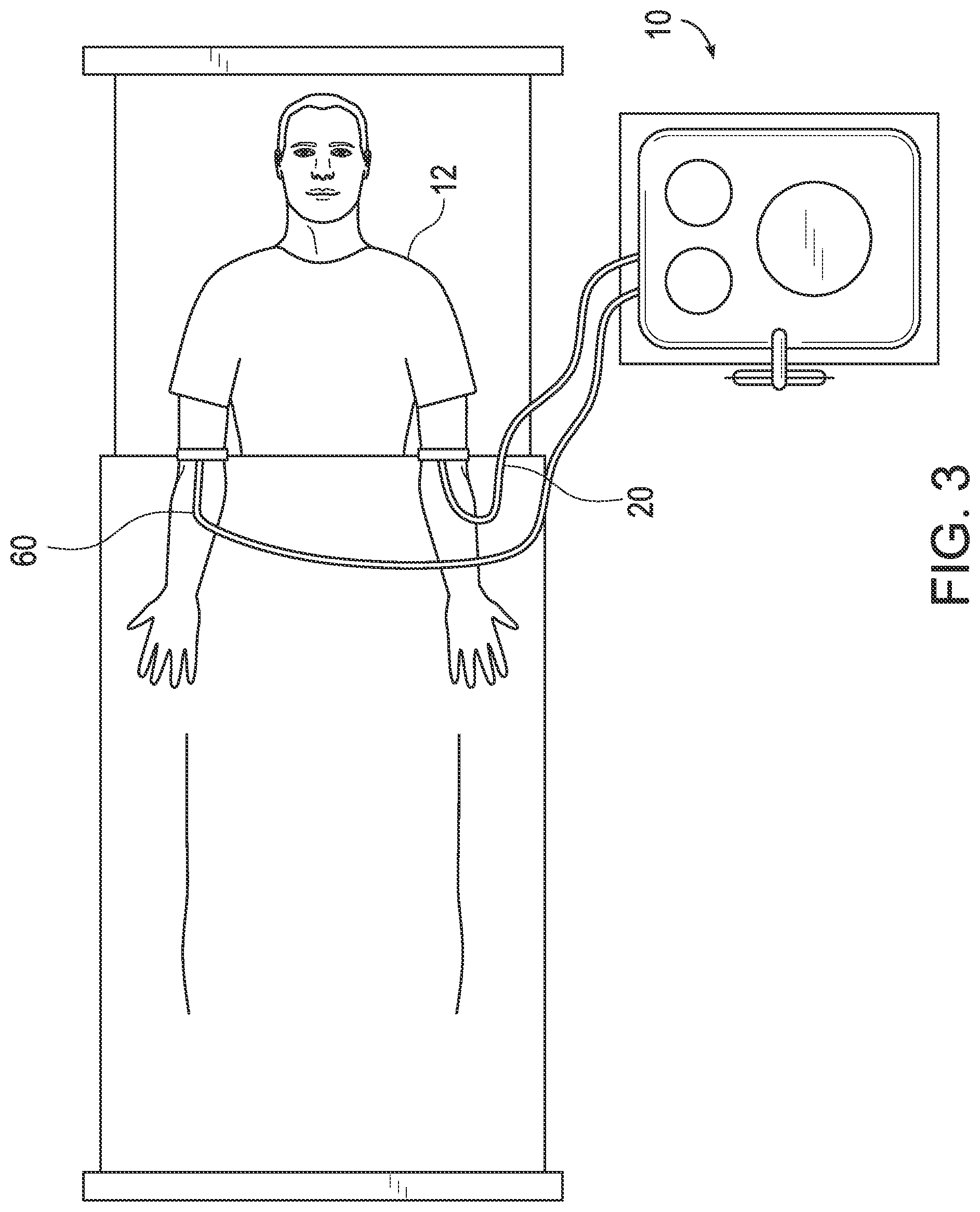 Patent US12311368 Figure 3 – Biological fluid filtration system