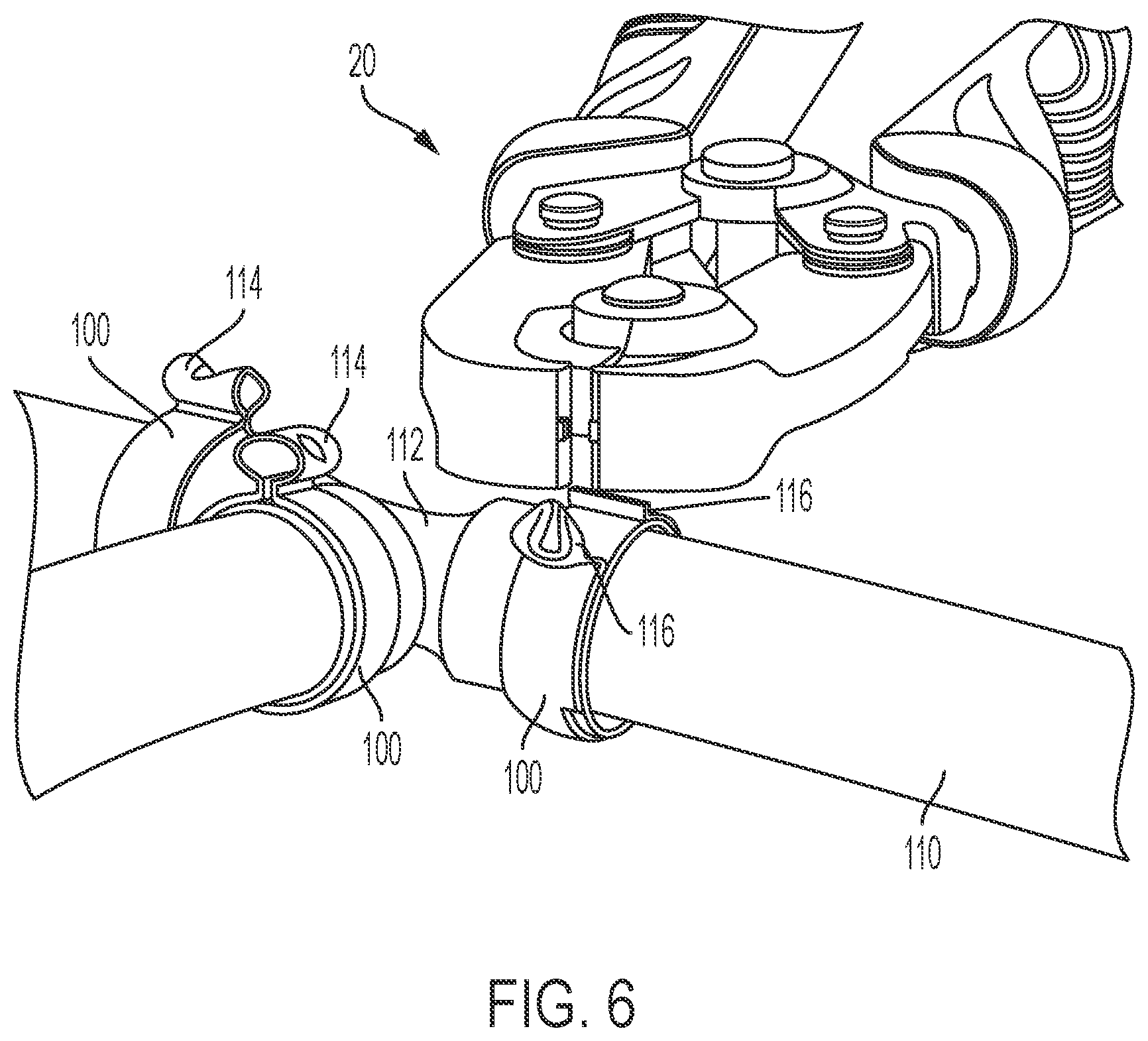 Patent US12311515 Figure 6 – Cutting tool for band clamp