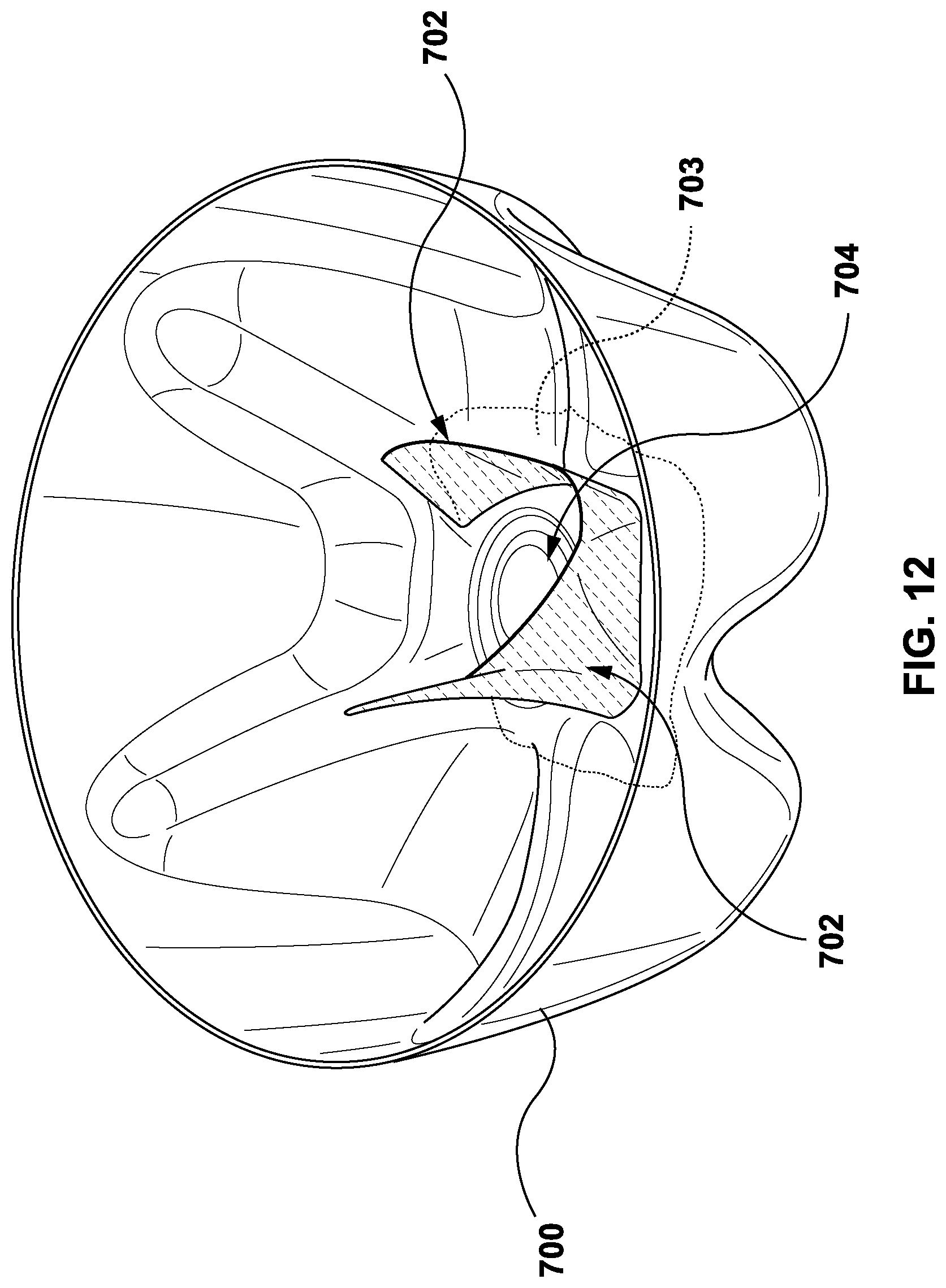 Patent US12311591 Figure 10 – Injection molding of multilayer articles with post-pullback pressure monitoring