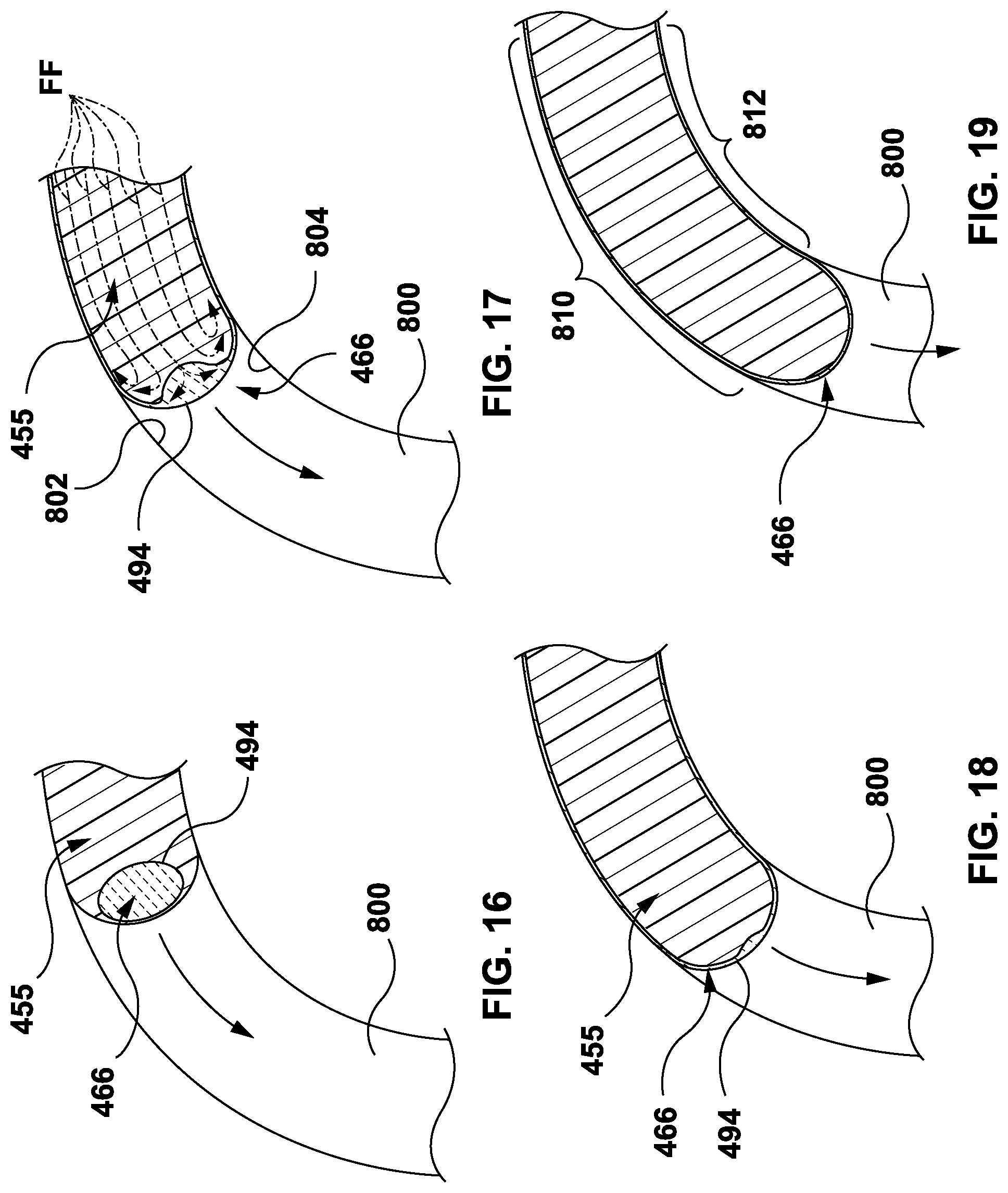 Patent US12311591 Figure 13 – Injection molding of multilayer articles with post-pullback pressure monitoring