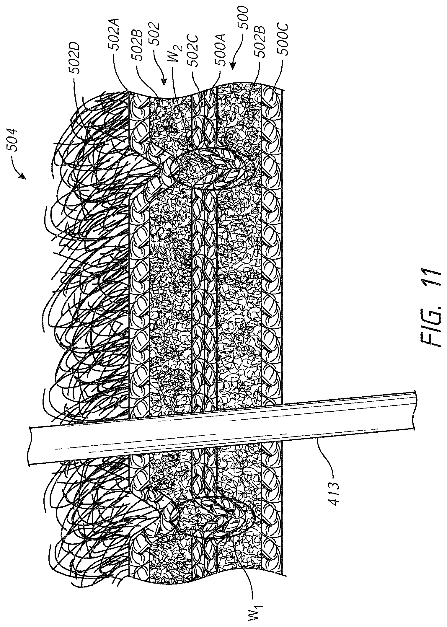 Patent US12311609 Figure 15 – High-frequency welding for headgear