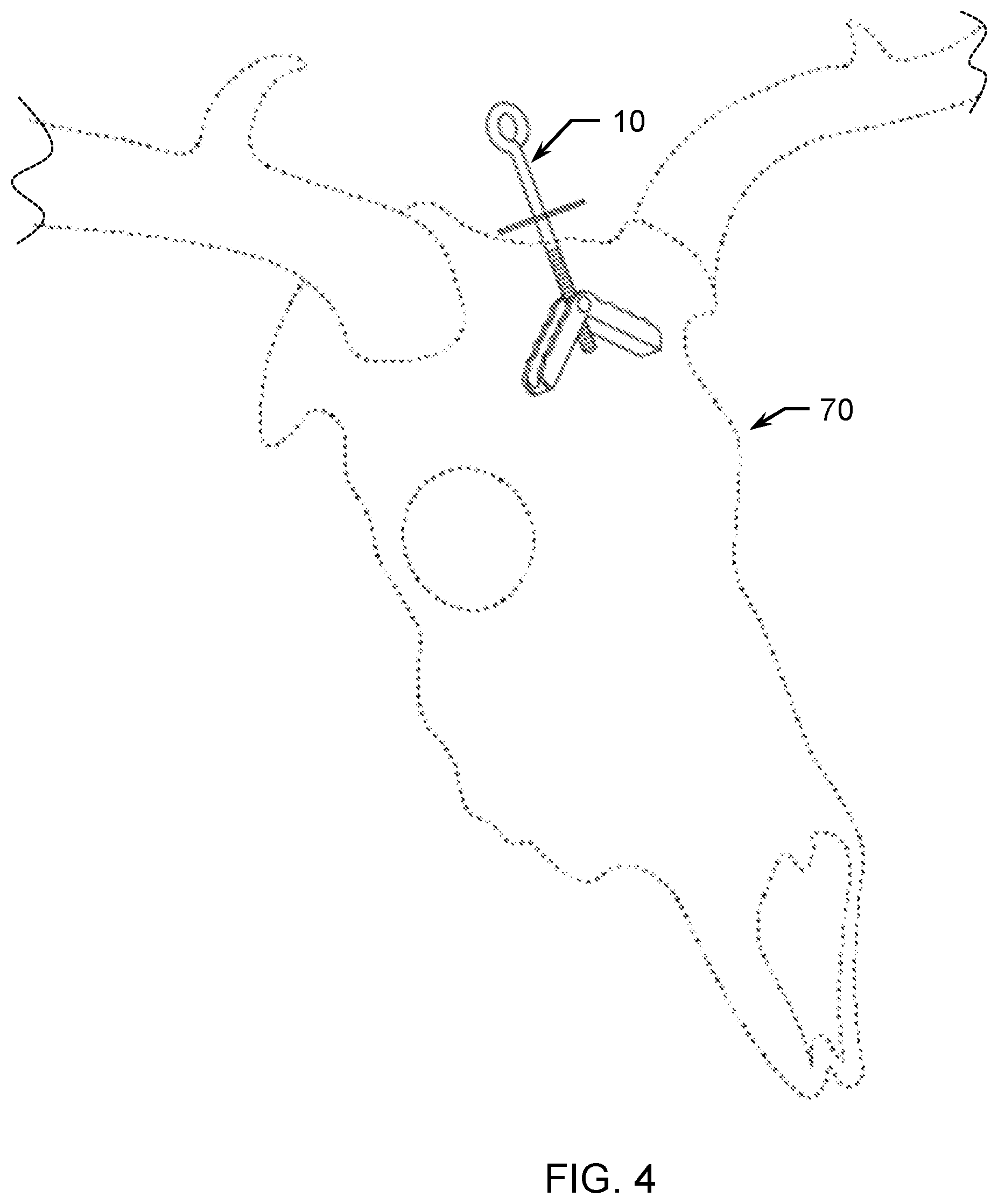 Patent US12311695 Figure 4 – Taxidermy display apparatus and method of use
