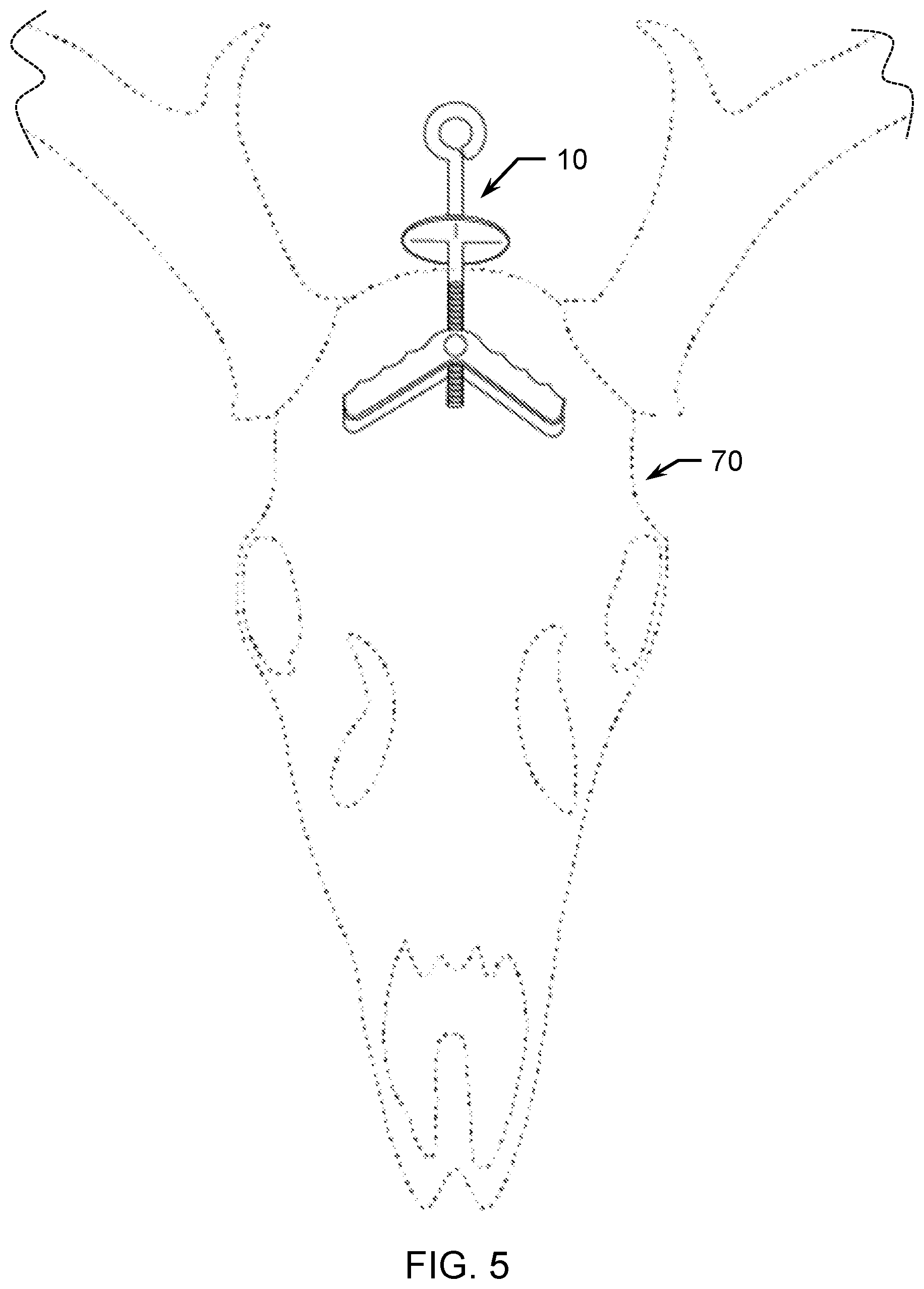 Patent US12311695 Figure 5 – Taxidermy display apparatus and method of use
