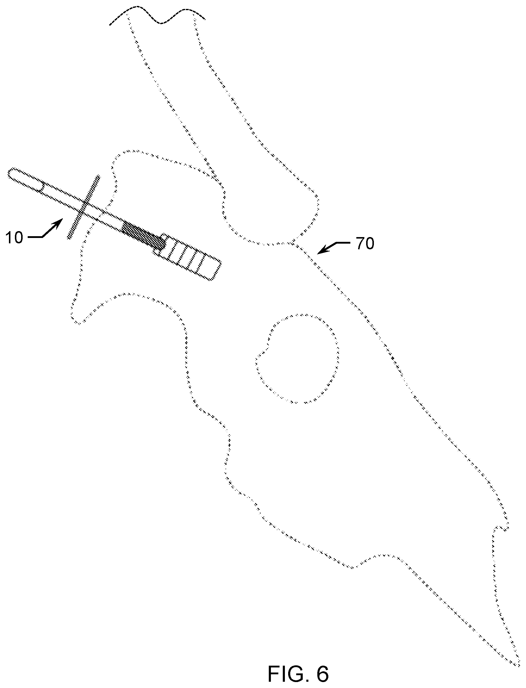 Patent US12311695 Figure 6 – Taxidermy display apparatus and method of use