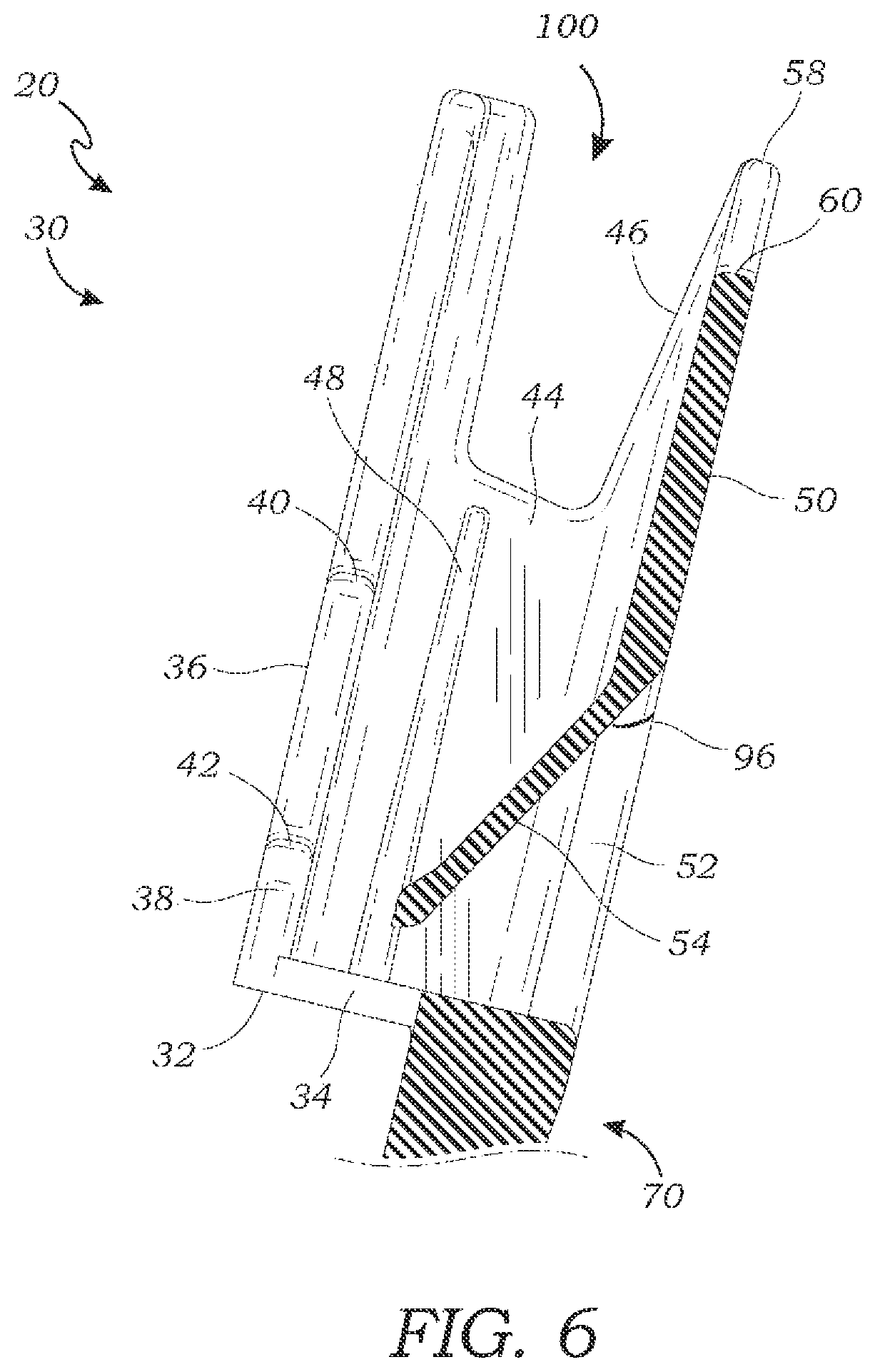 Patent US12311846 Figure 6 – Retainer for a mobile device and method of use thereof